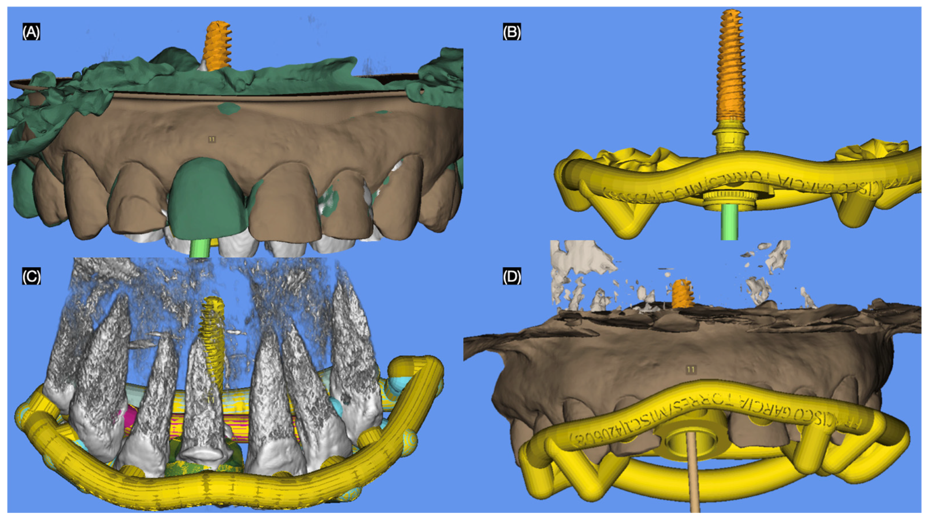 Dentistry 13 00365 g003 Dentistry 13 00365 g003