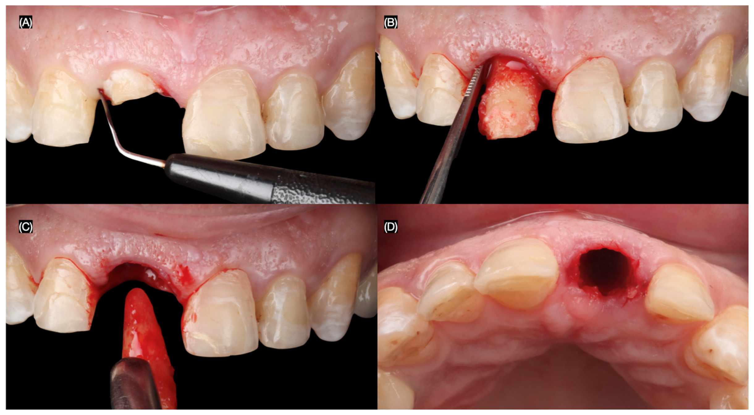 Dentistry 13 00365 g004 Dentistry 13 00365 g004