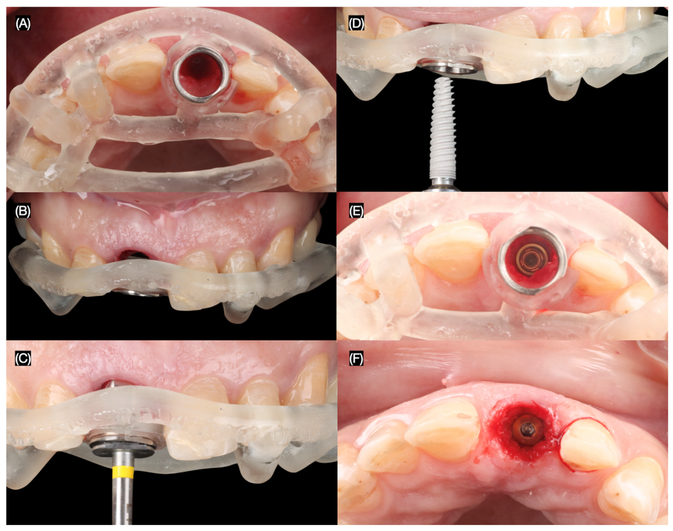 Dentistry 13 00365 g005 Dentistry 13 00365 g005