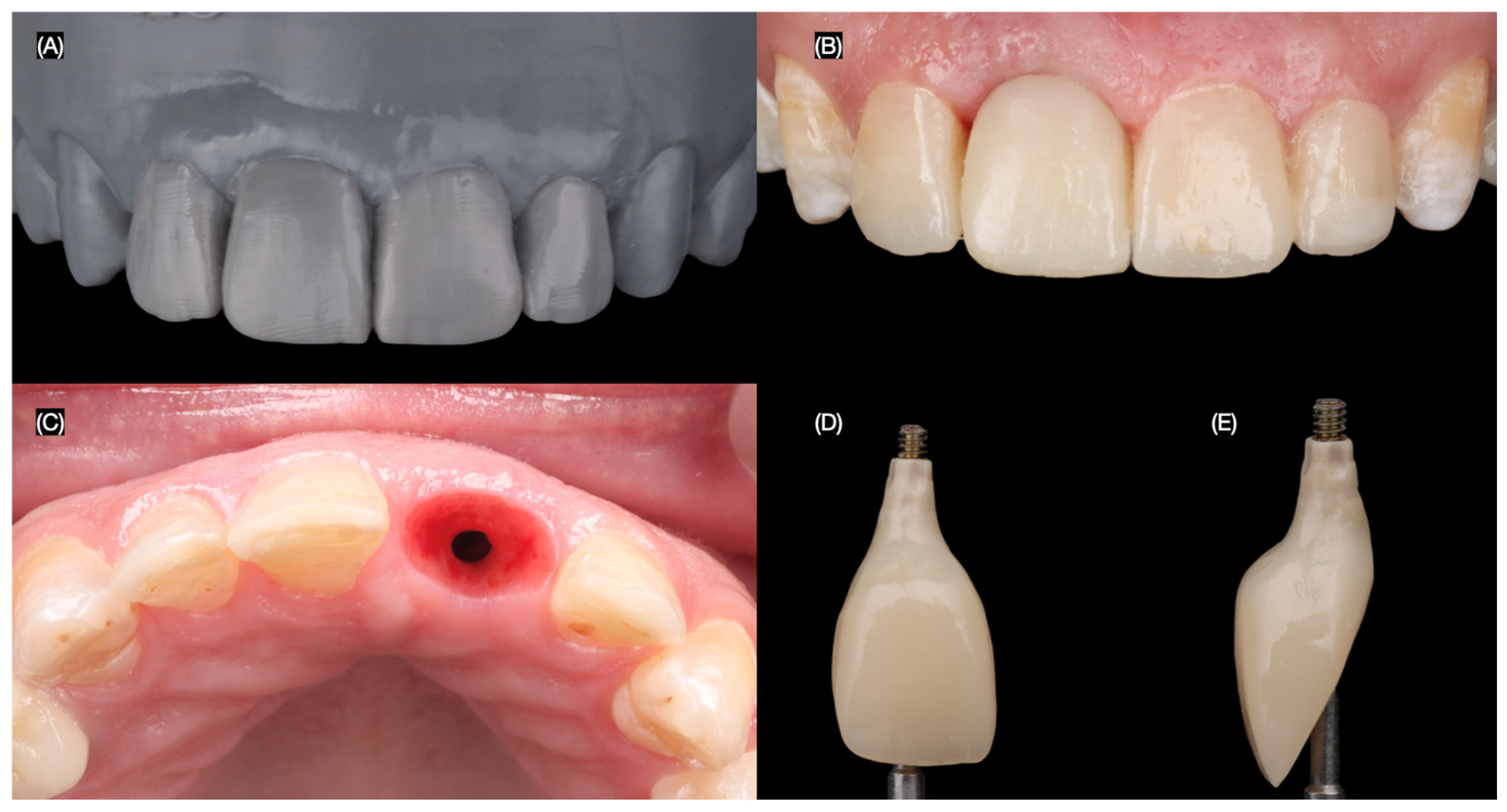 Dentistry 13 00365 g007 Dentistry 13 00365 g007