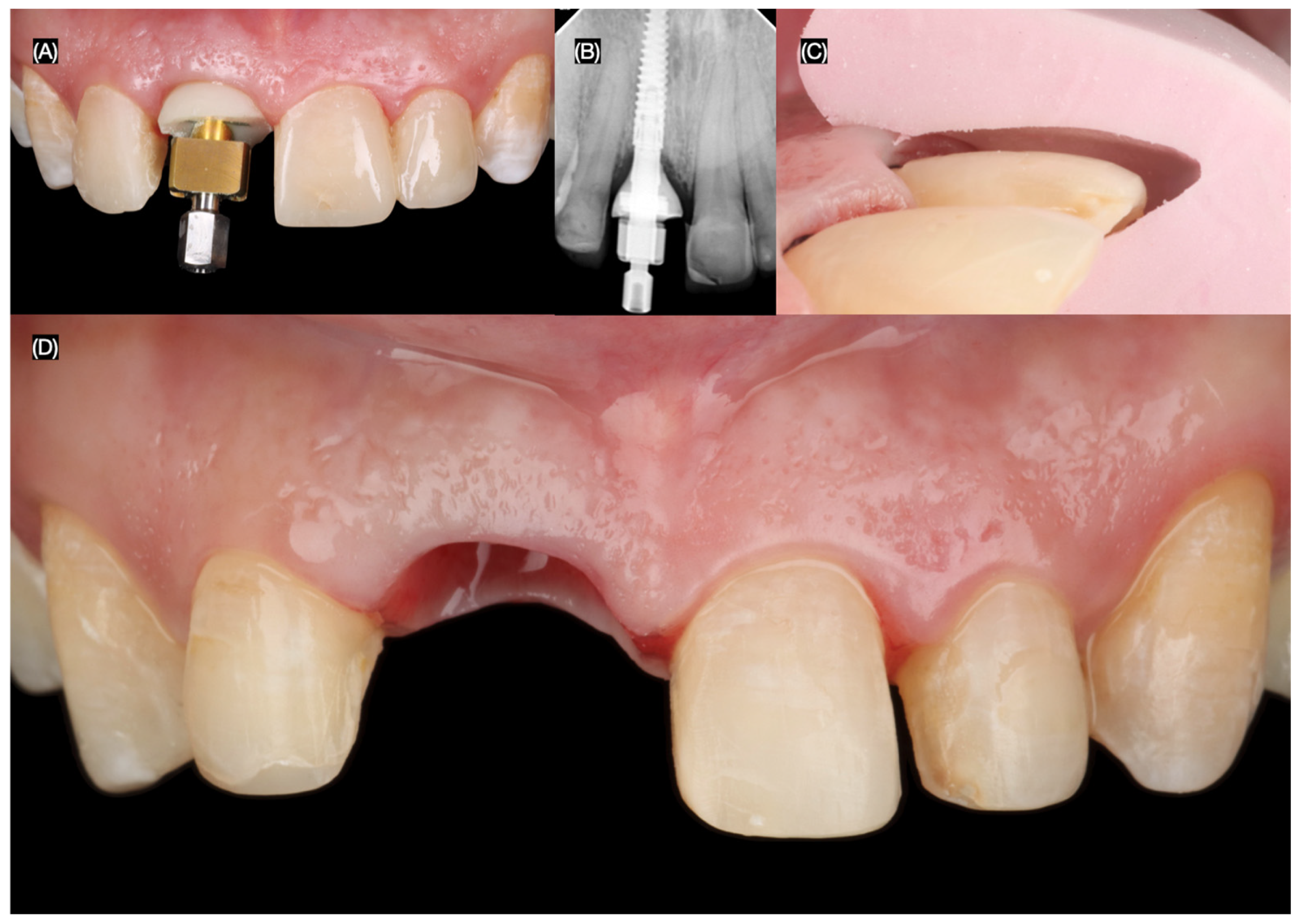 Dentistry 13 00365 g008 Dentistry 13 00365 g008