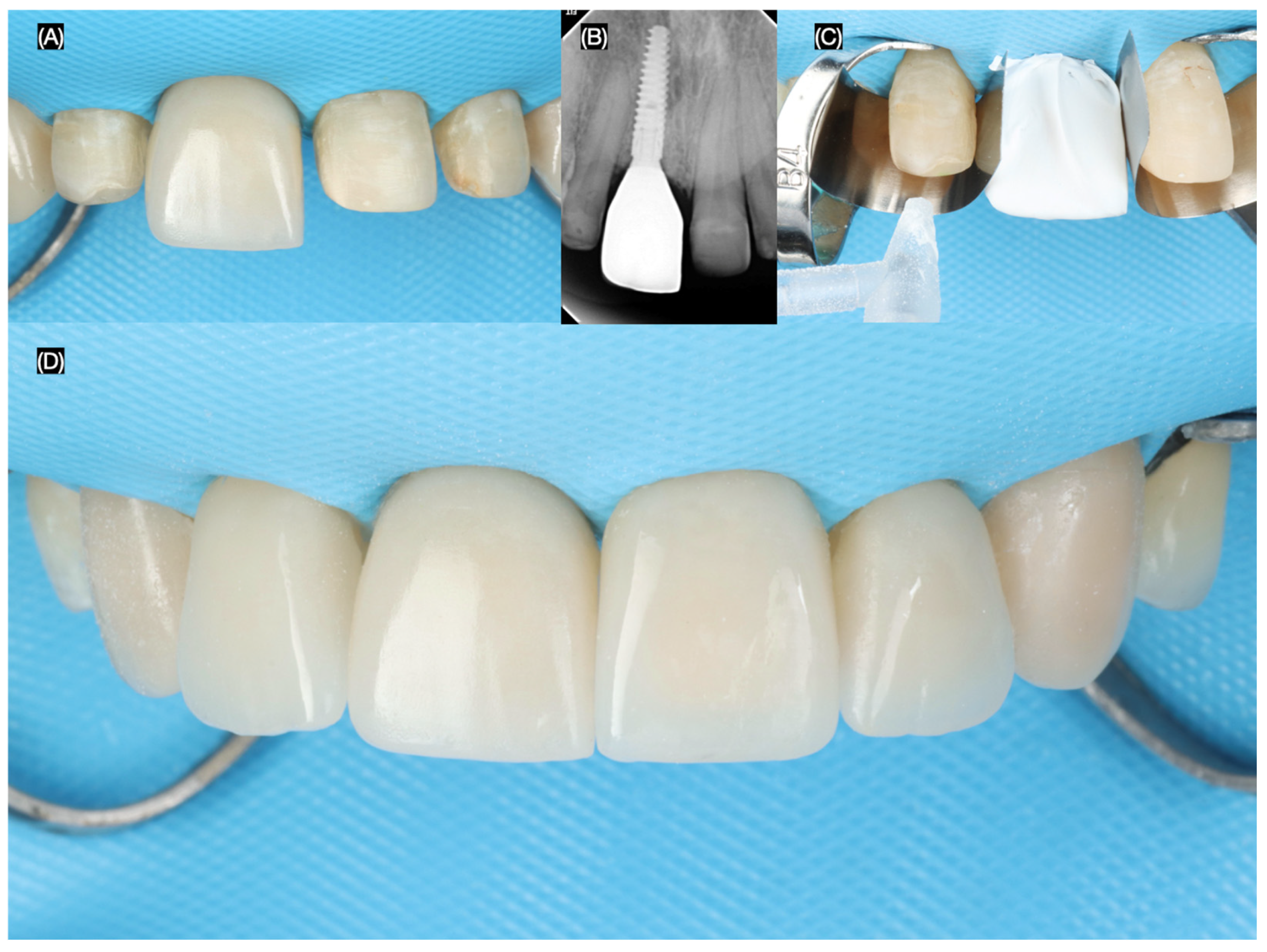 Dentistry 13 00365 g009 Dentistry 13 00365 g009