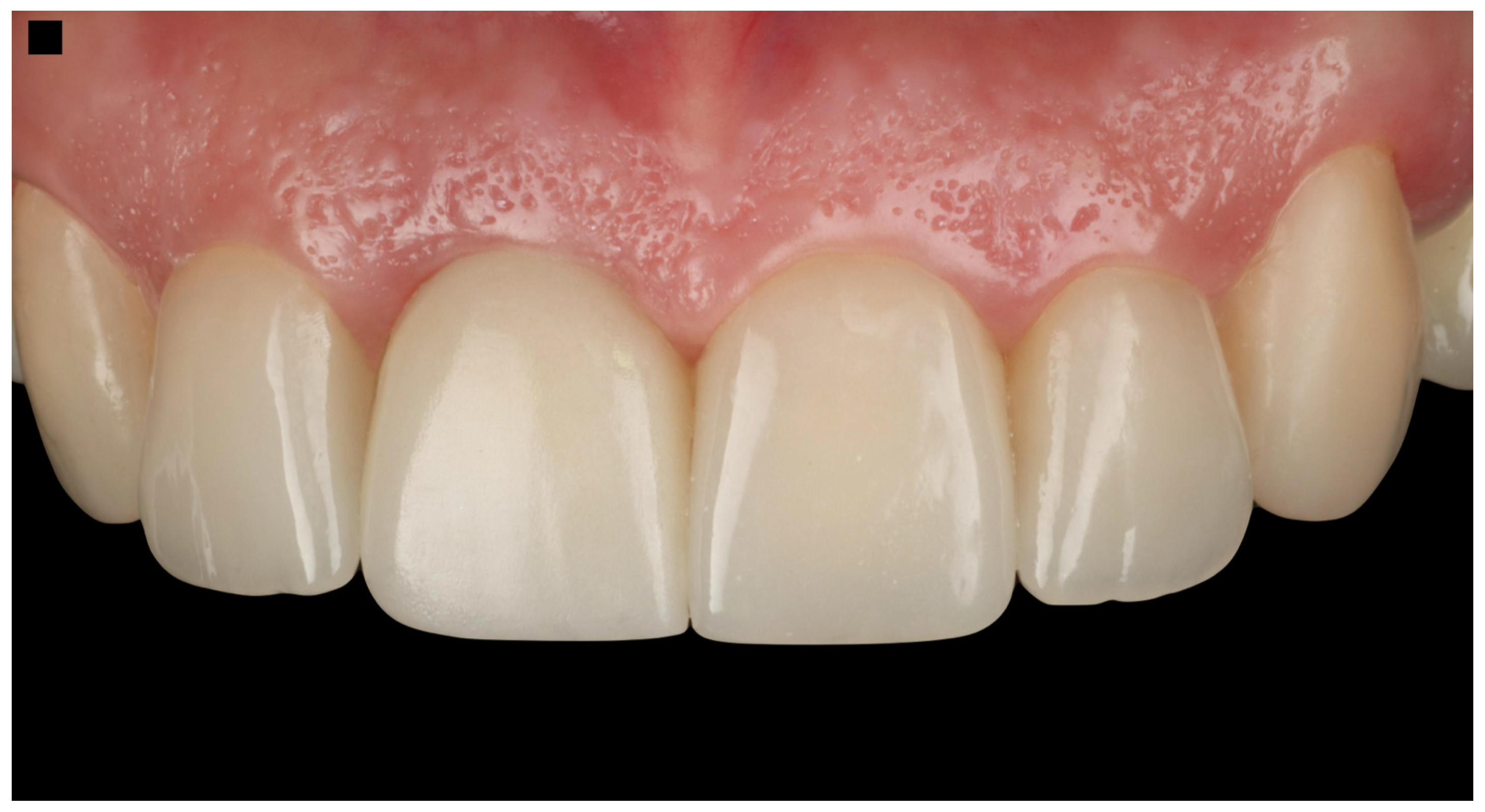 Dentistry 13 00365 g010 Dentistry 13 00365 g010