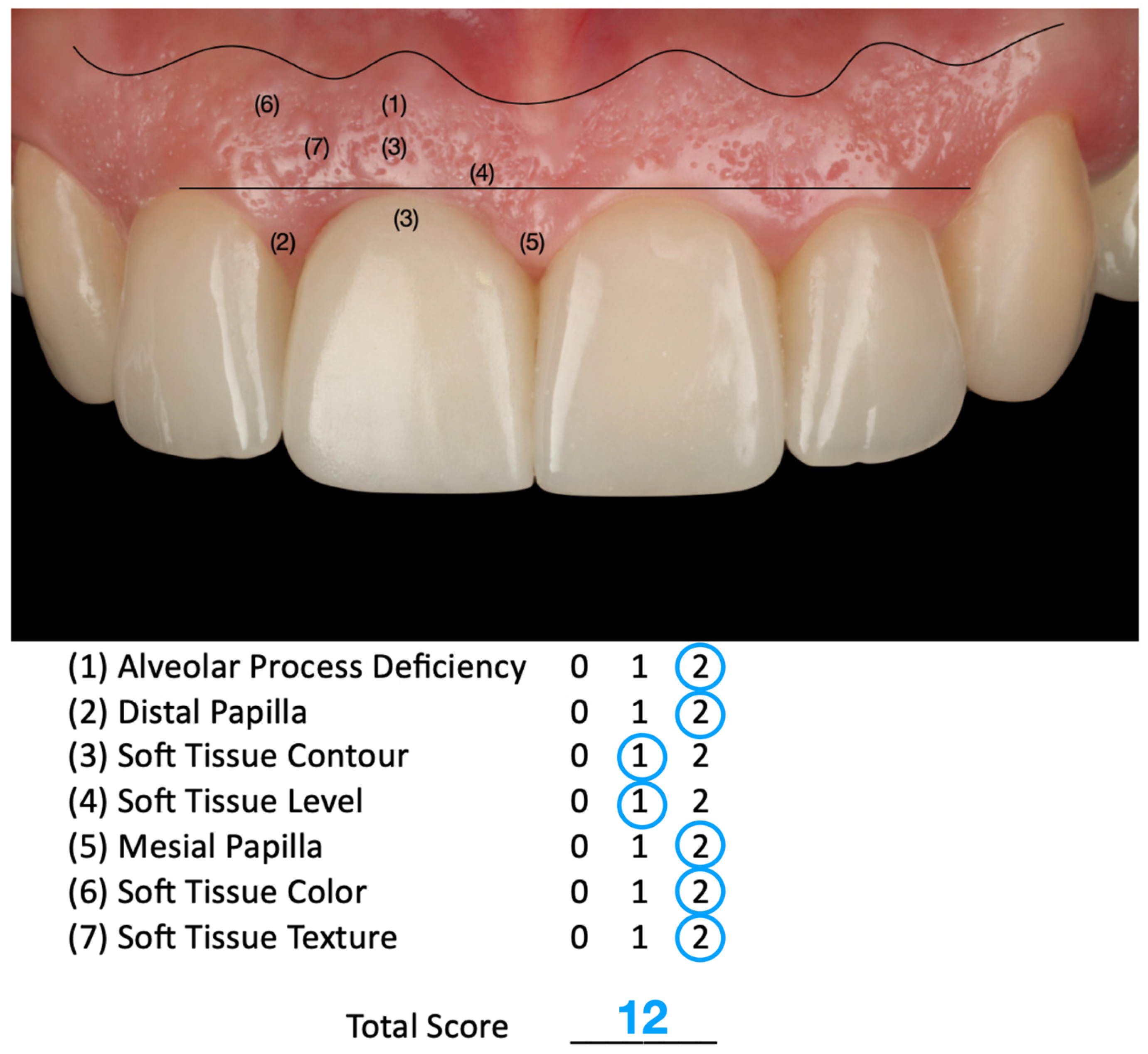 Dentistry 13 00365 g011 Dentistry 13 00365 g011