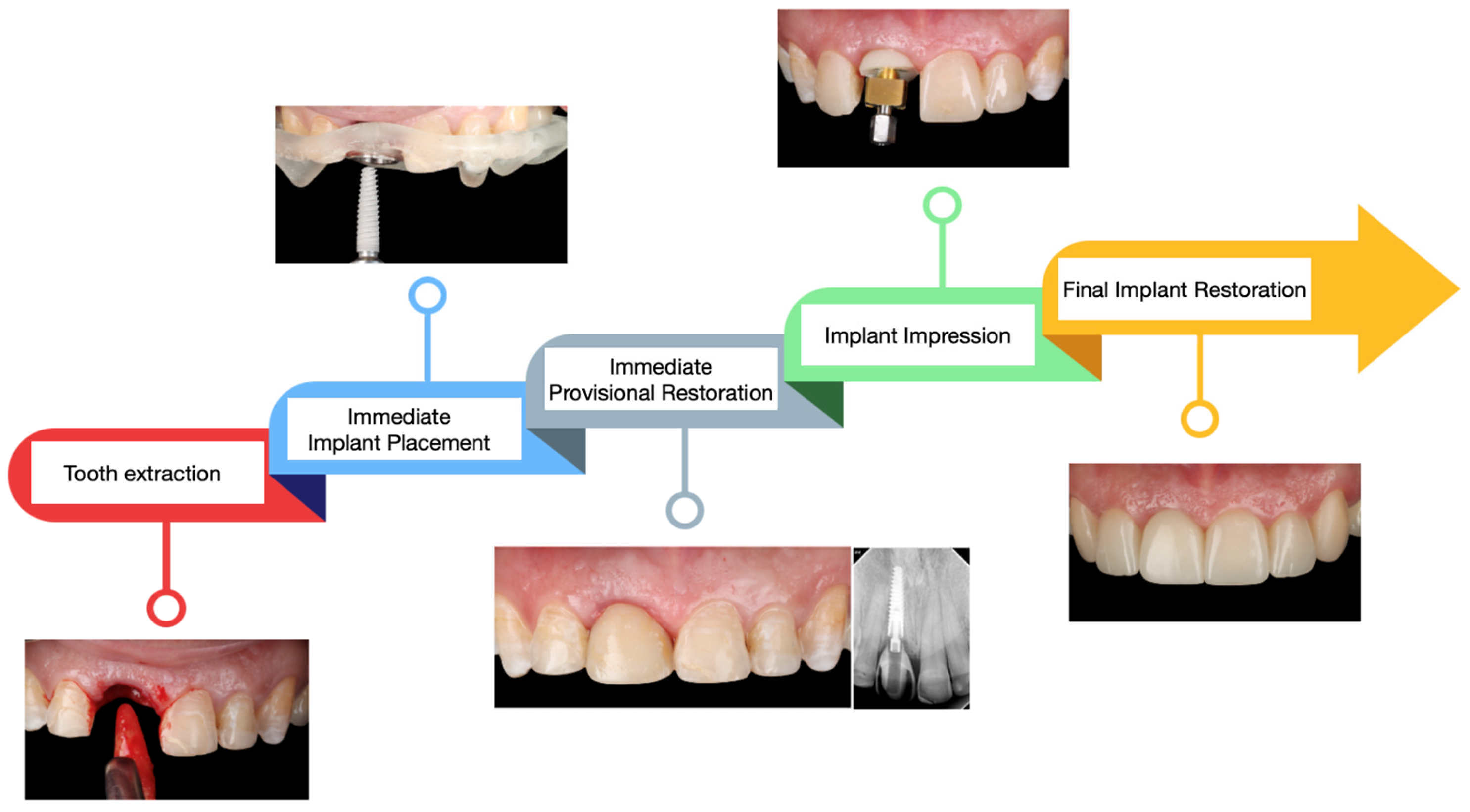Dentistry 13 00365 g012 Dentistry 13 00365 g012