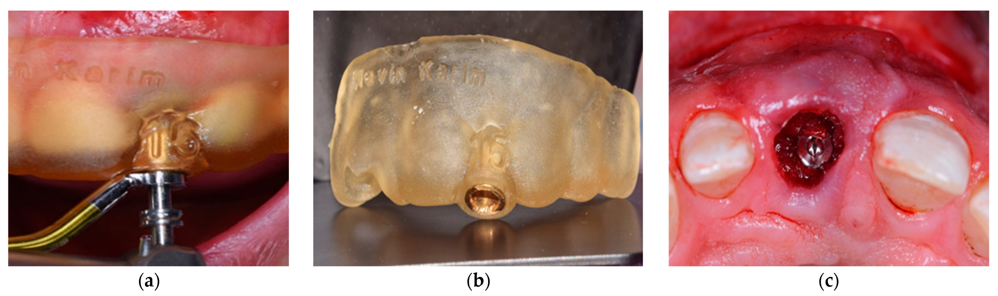 Dentistry 13 00371 g001