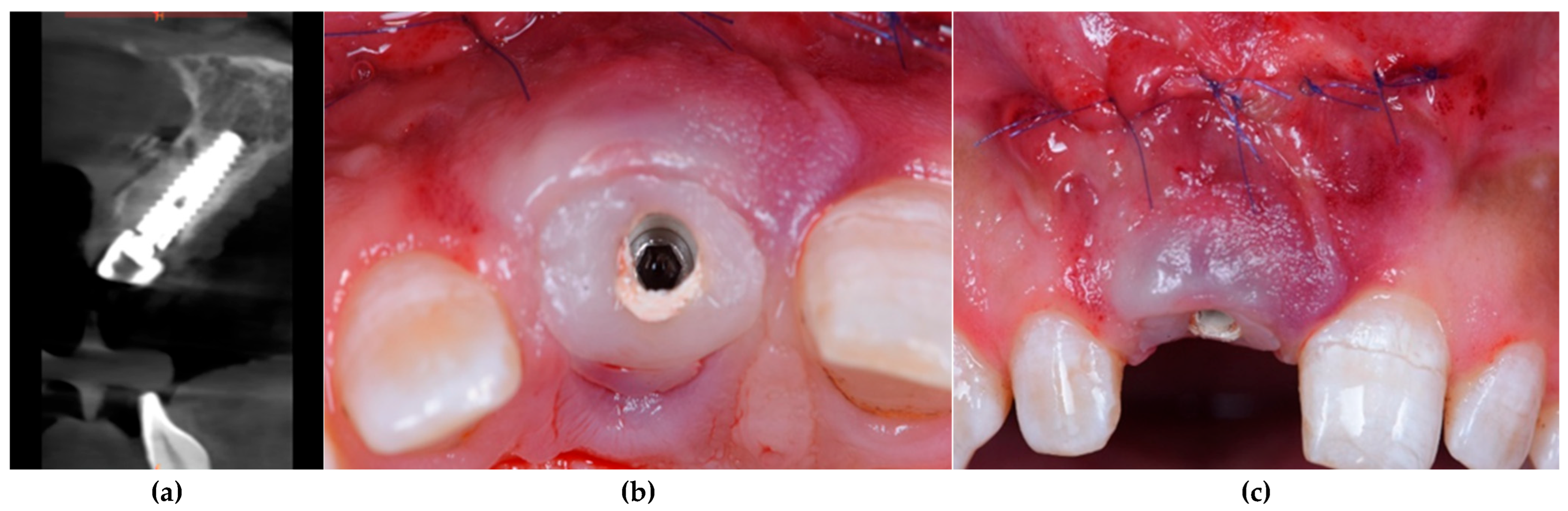 Dentistry 13 00371 g002