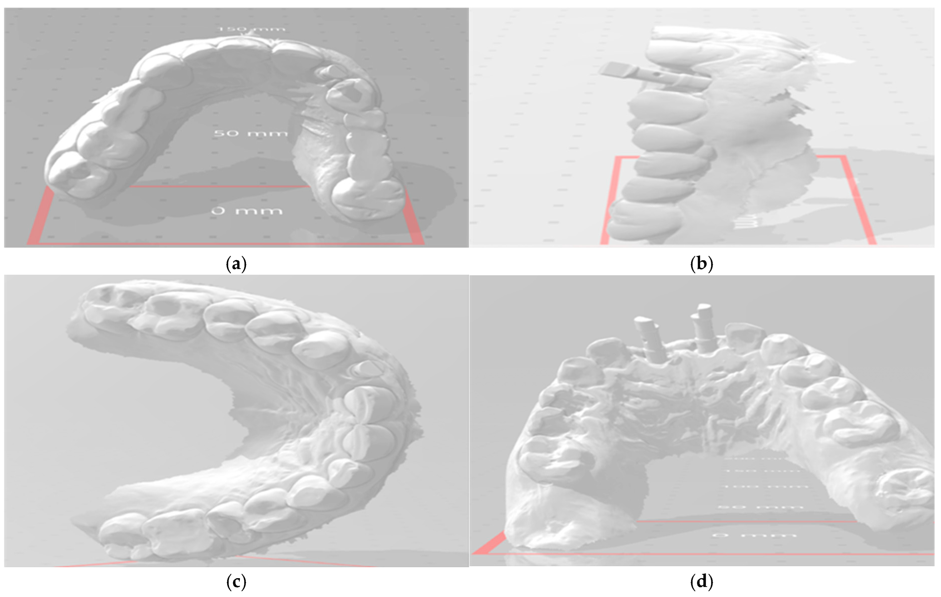 Dentistry 13 00371 g003