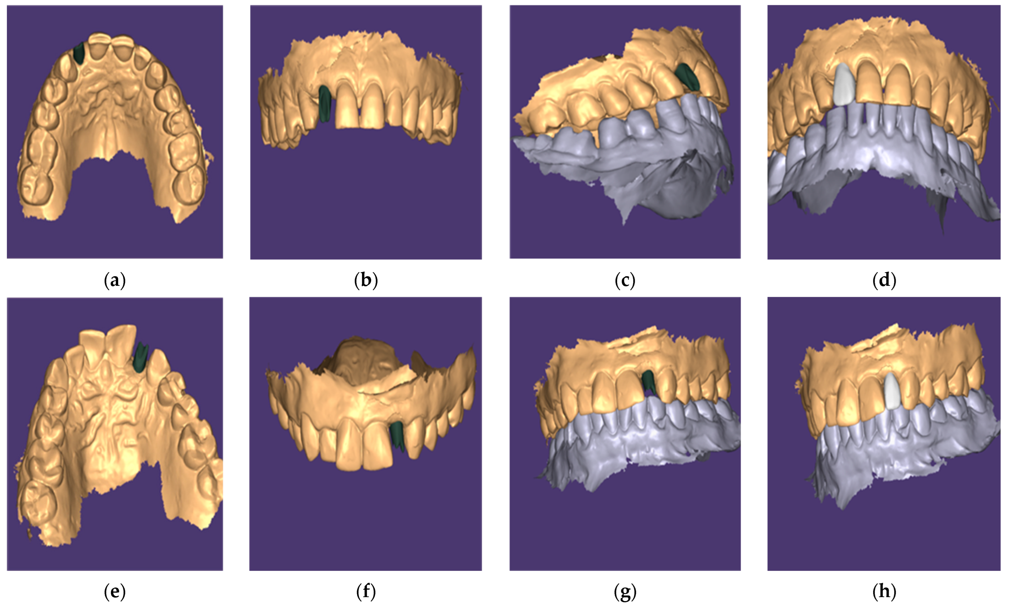 Dentistry 13 00371 g004