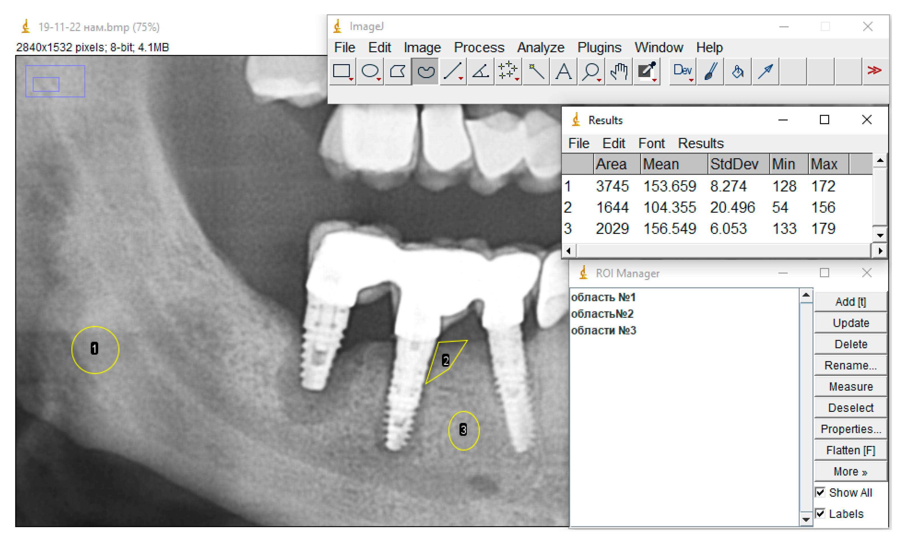 Dentistry 13 00375 g004