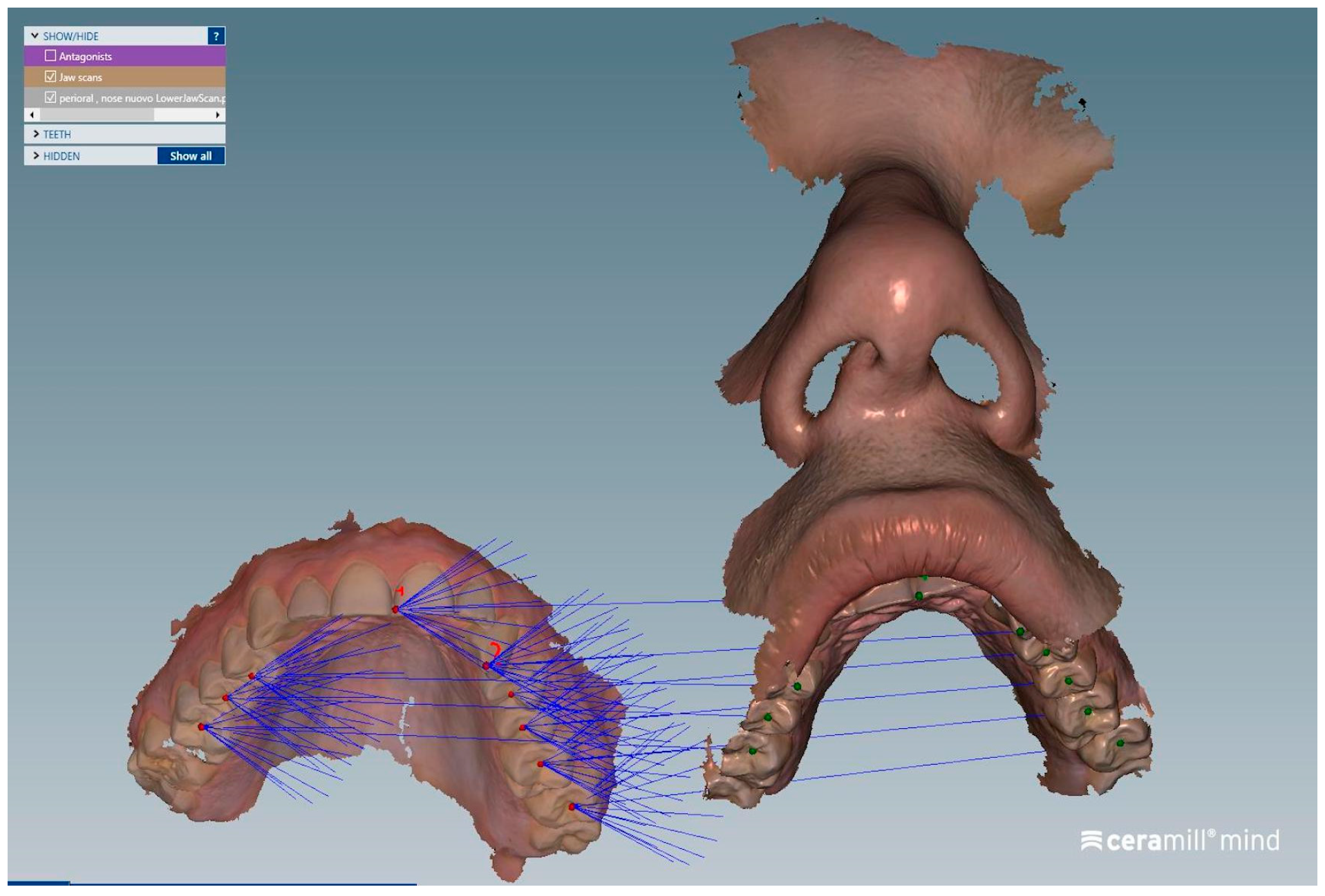 Dentistry 13 00378 g004