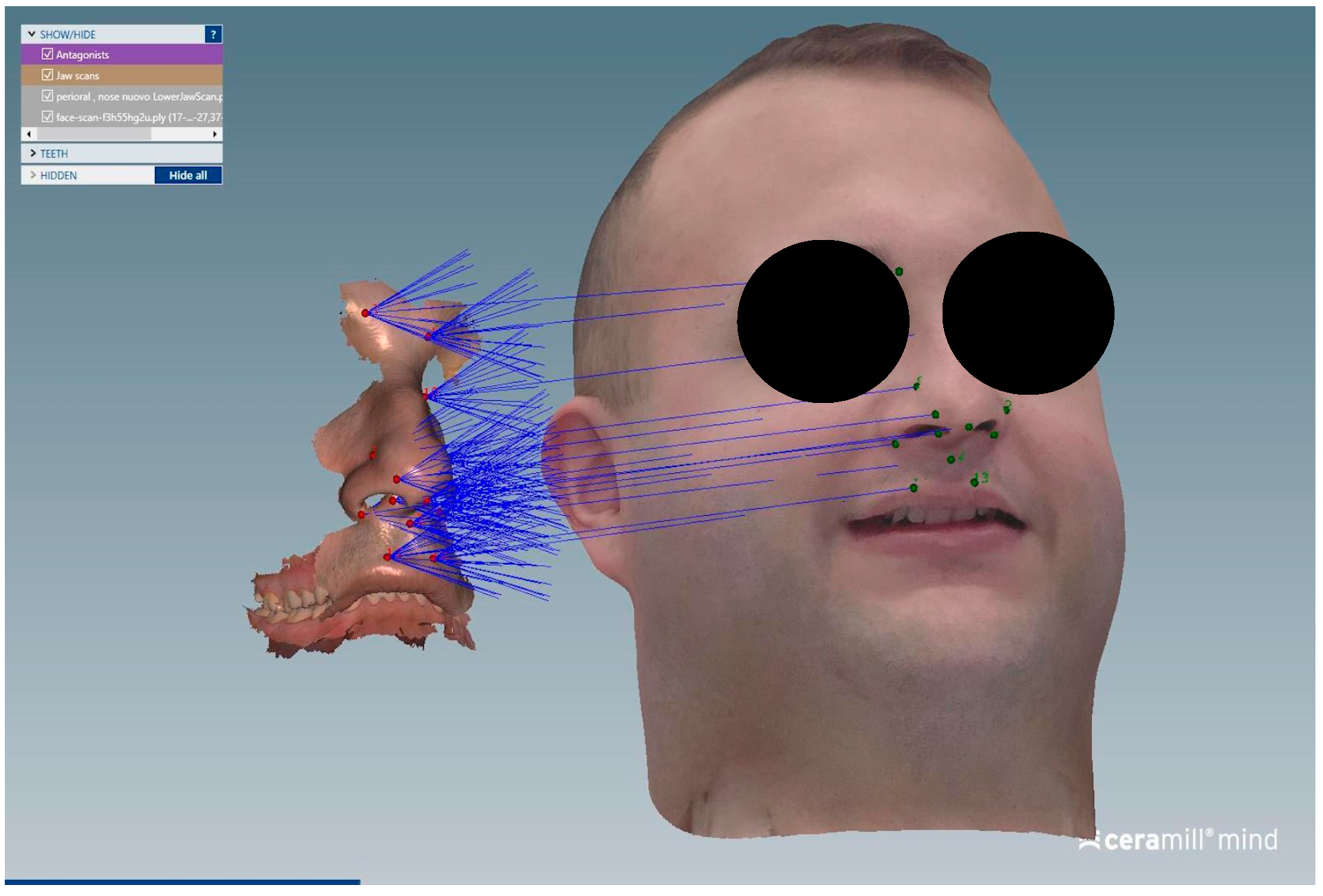 Dentistry 13 00378 g005