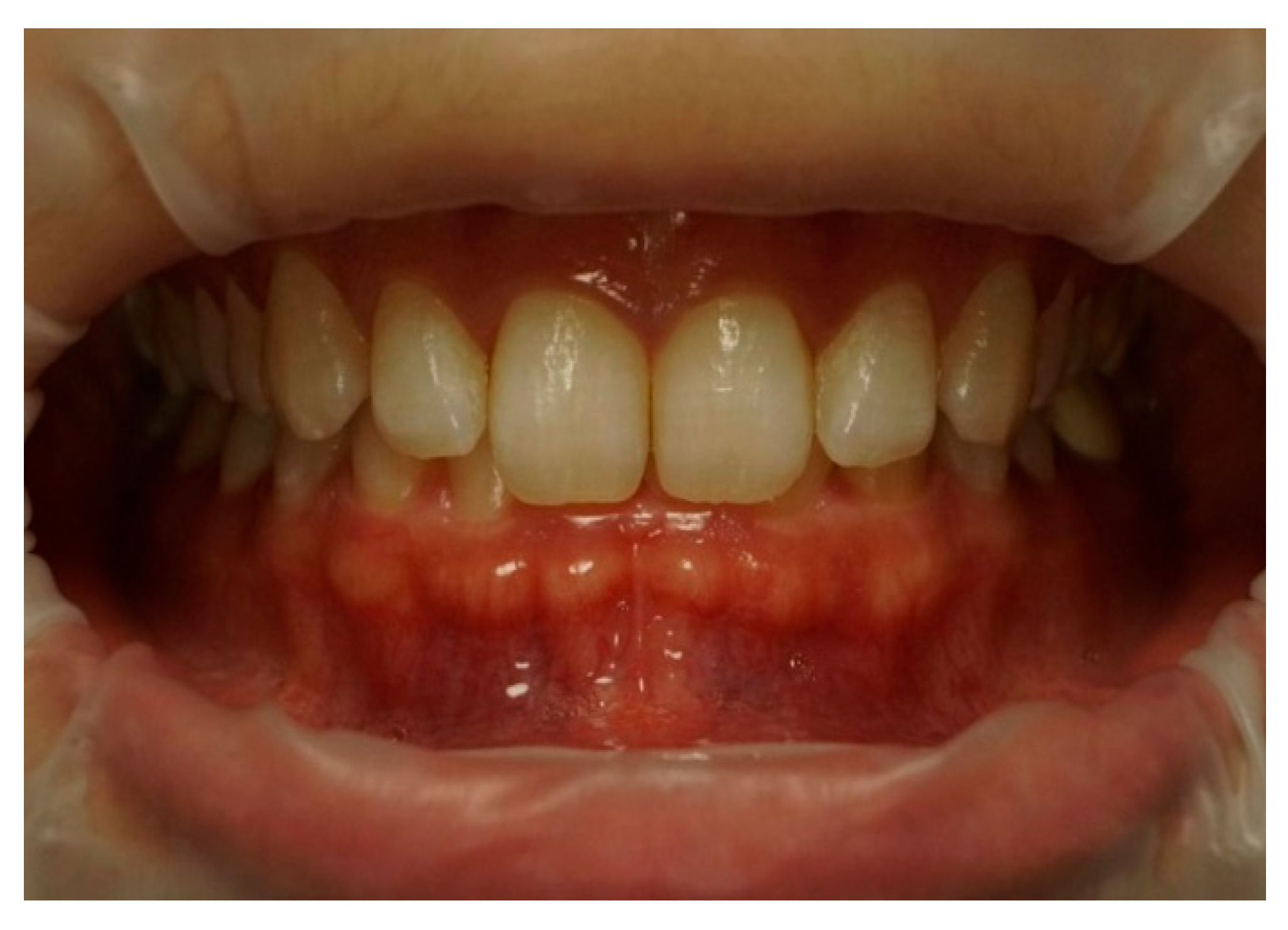 Dentistry 13 00380 g003