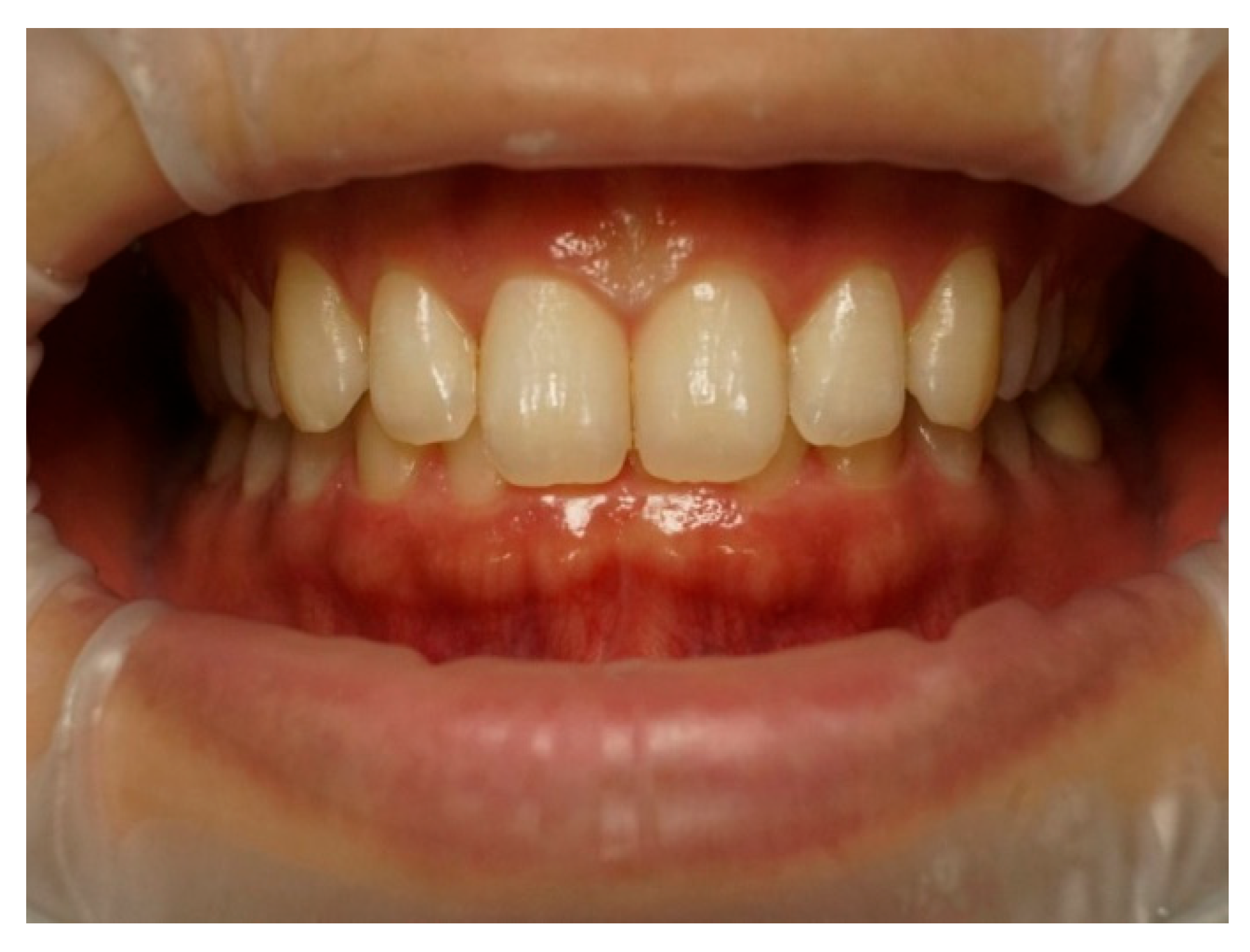 Dentistry 13 00380 g004