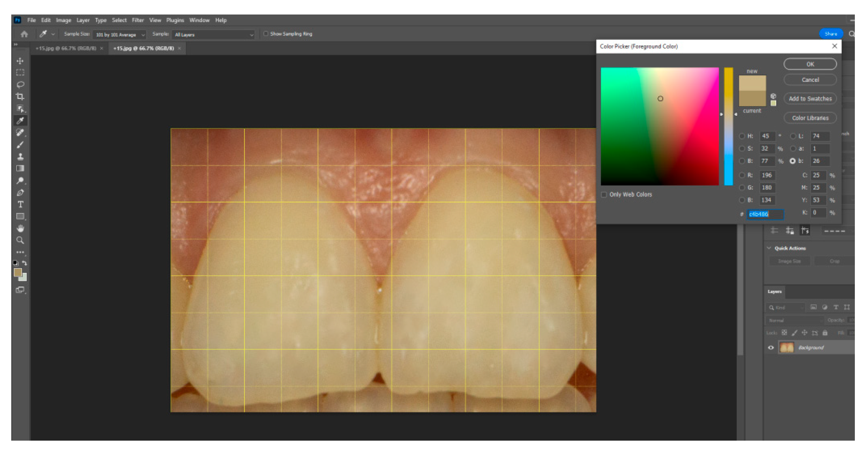 Dentistry 13 00380 g007