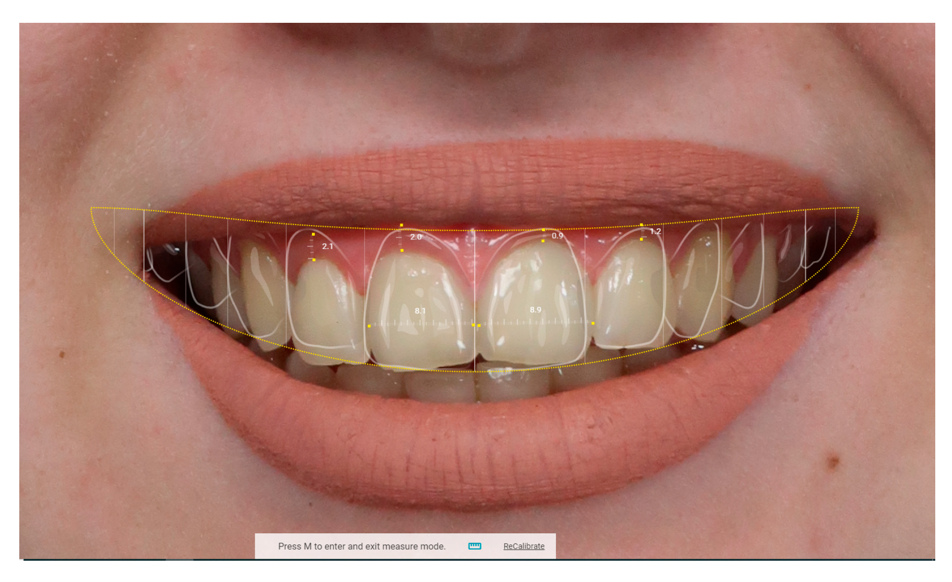 Dentistry 13 00380 g010