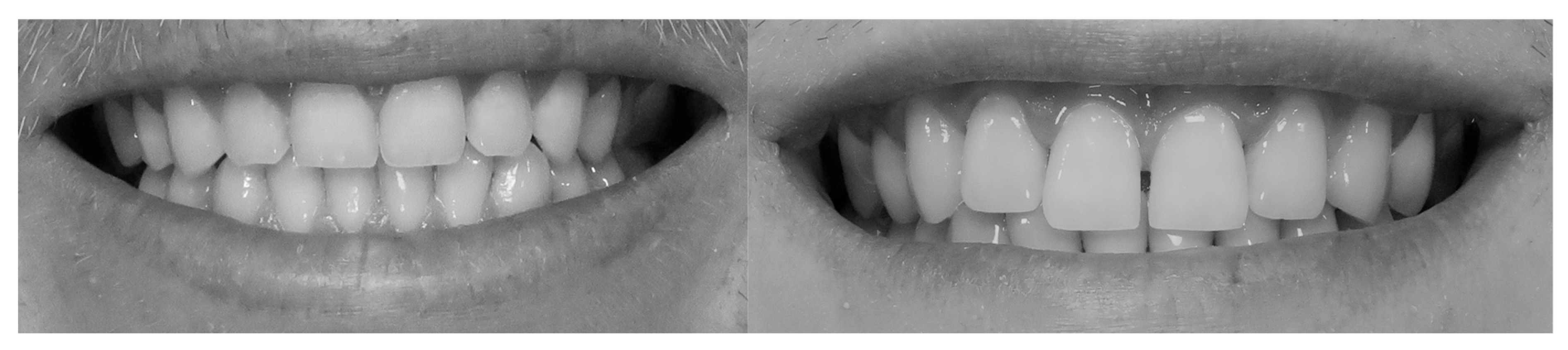 Dentistry 13 00380 g018