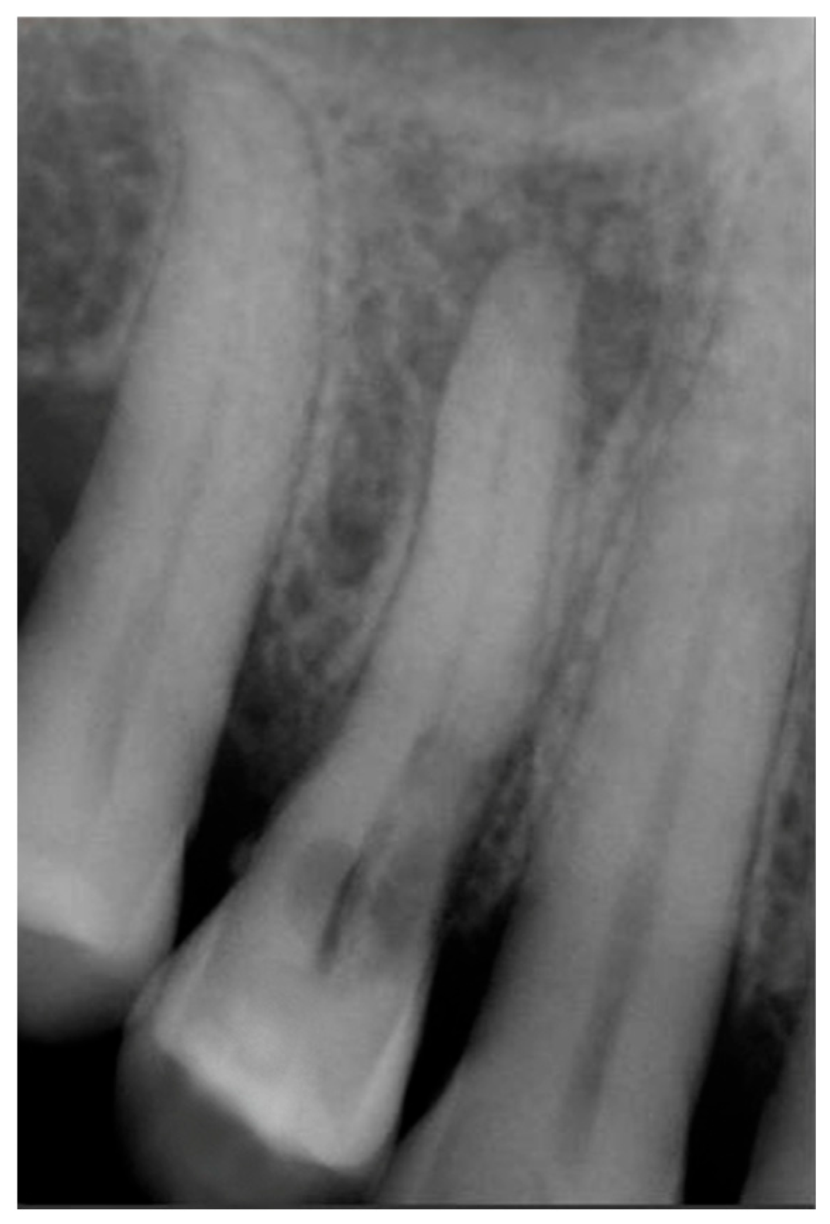 Dentistry 13 00388 g001