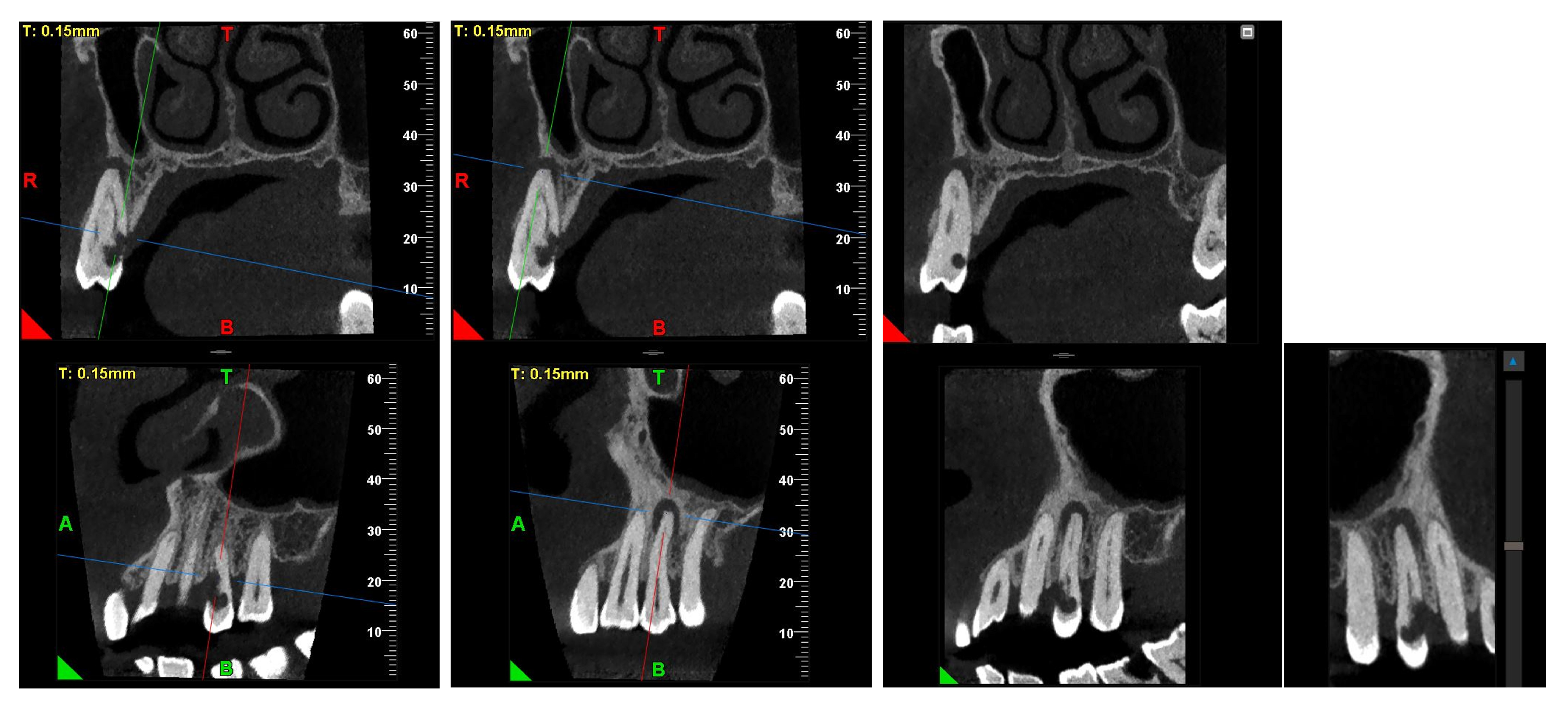 Dentistry 13 00388 g004