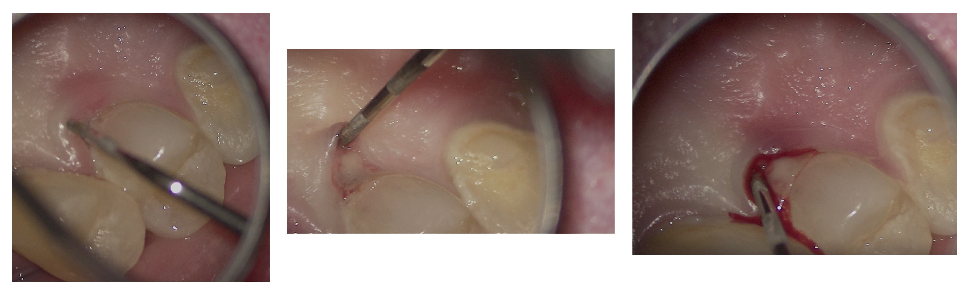 Dentistry 13 00388 g006