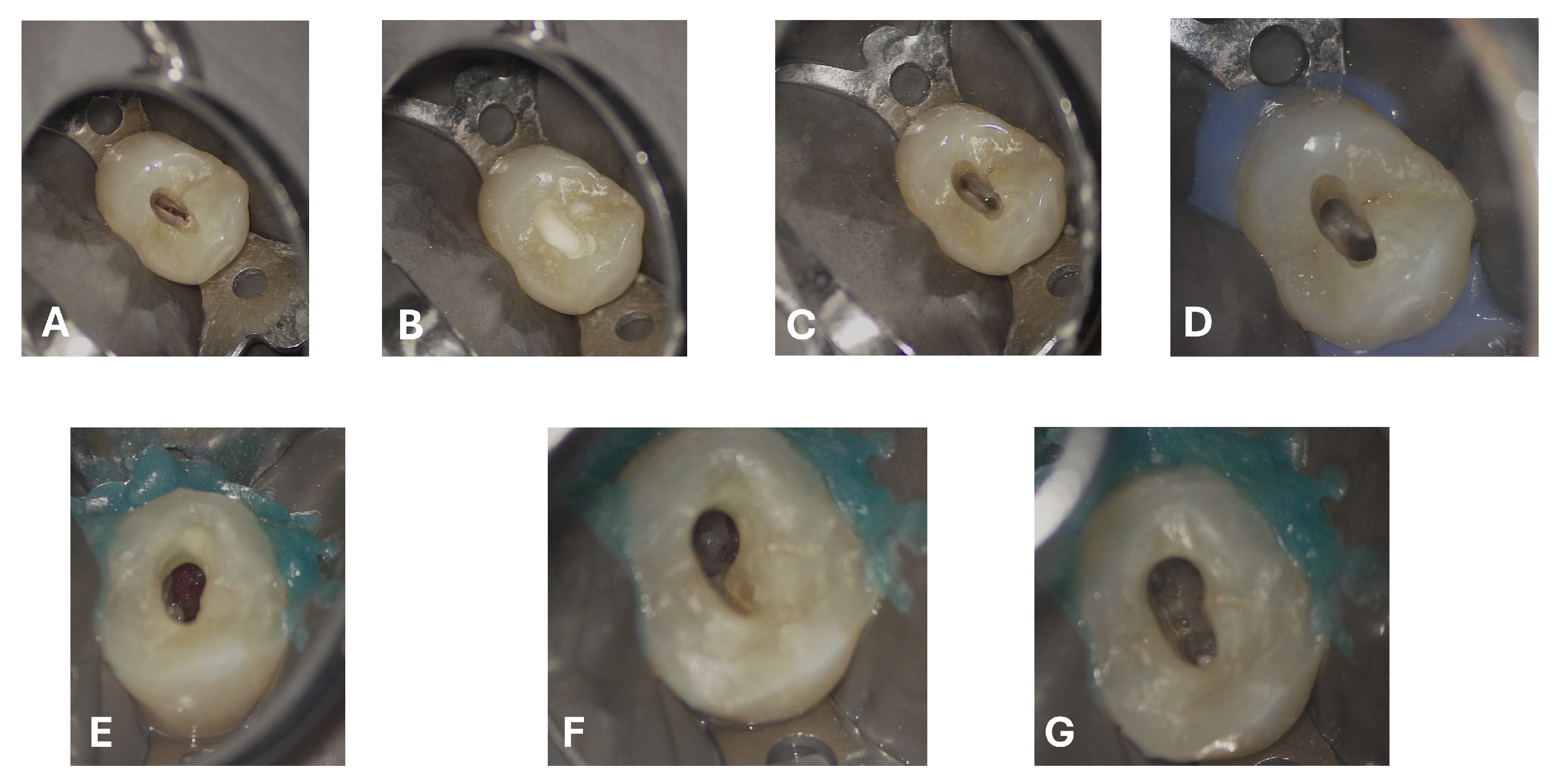 Dentistry 13 00388 g007