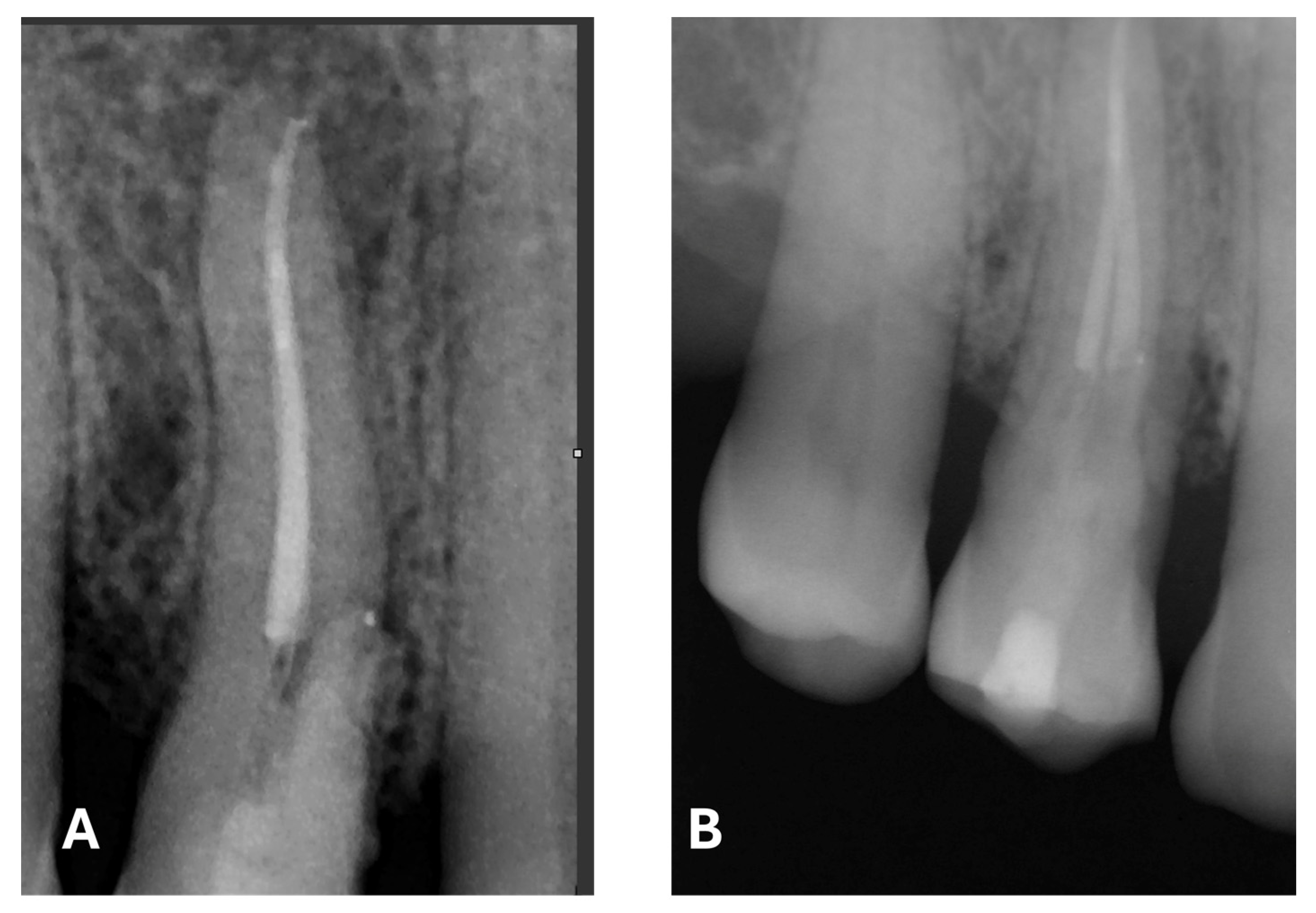 Dentistry 13 00388 g009