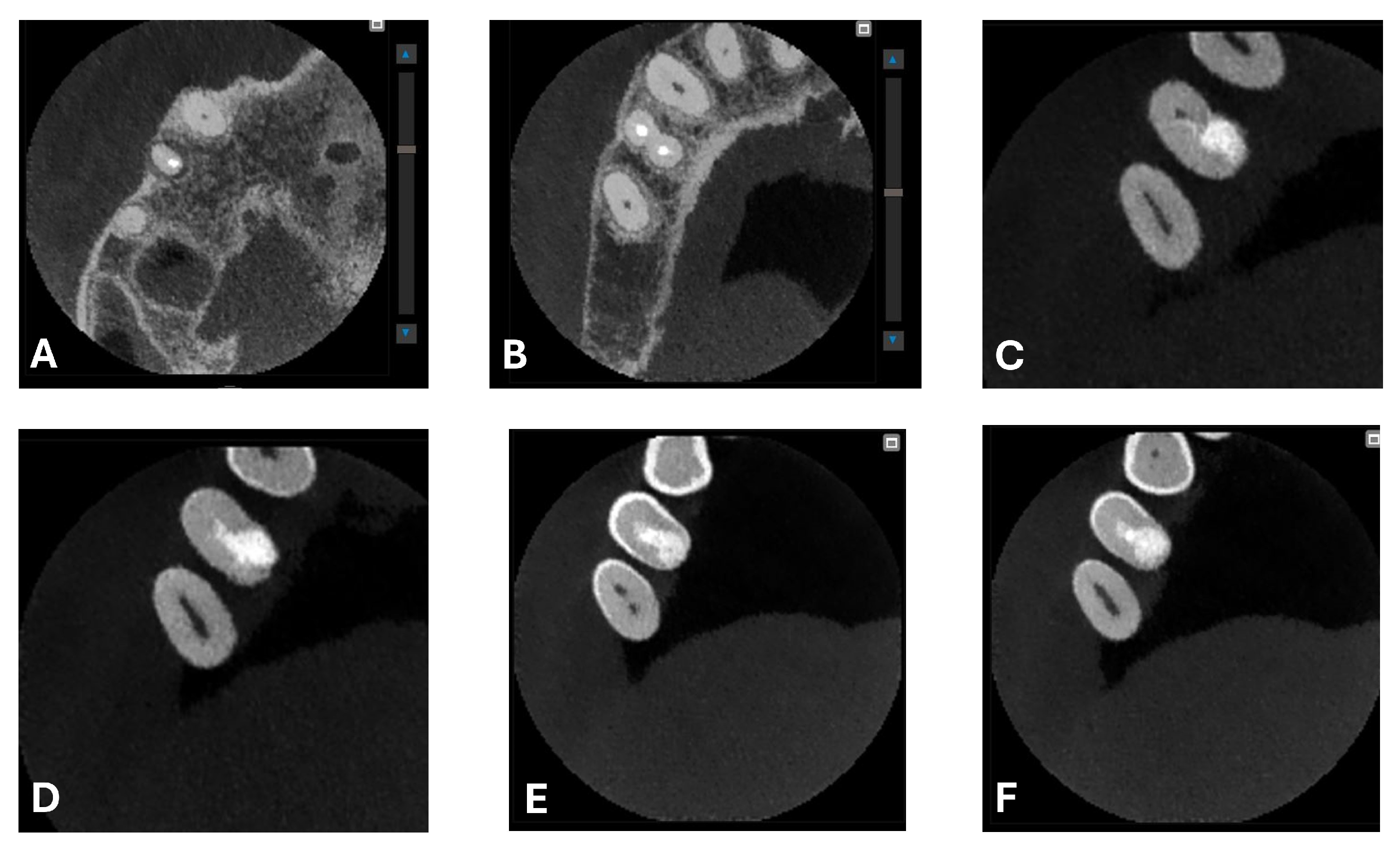 Dentistry 13 00388 g010