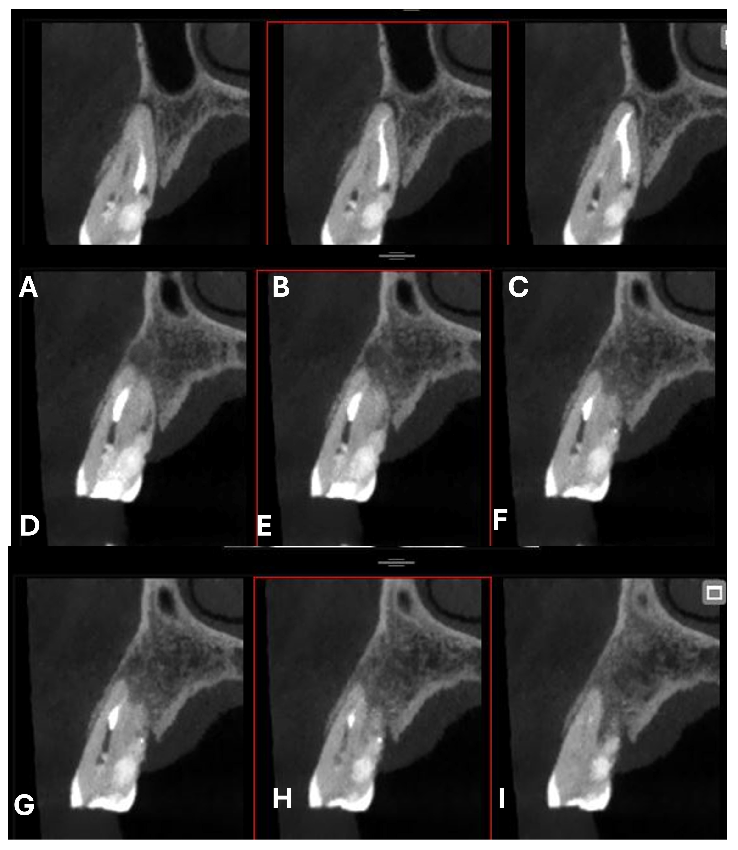 Dentistry 13 00388 g011
