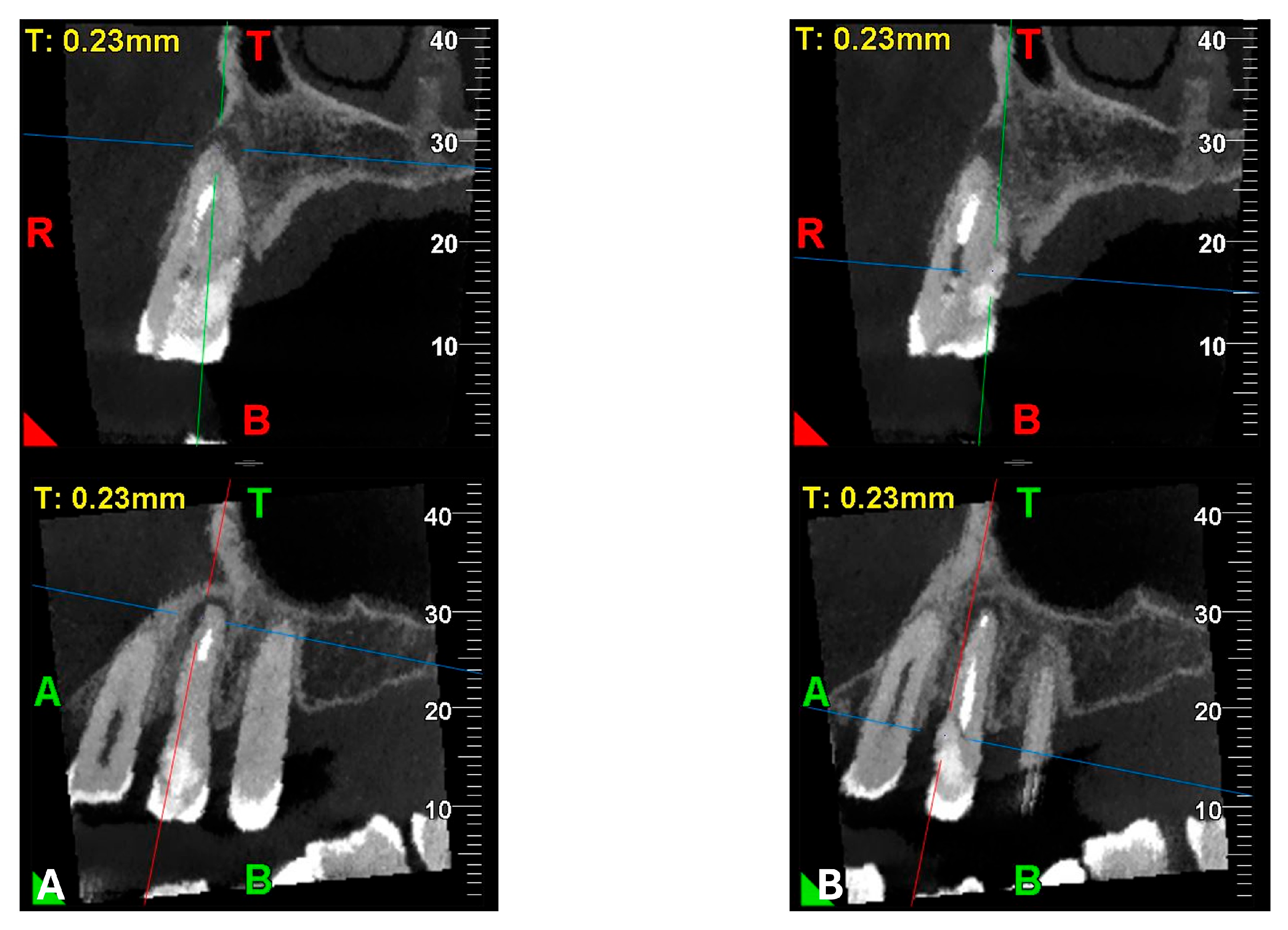 Dentistry 13 00388 g012