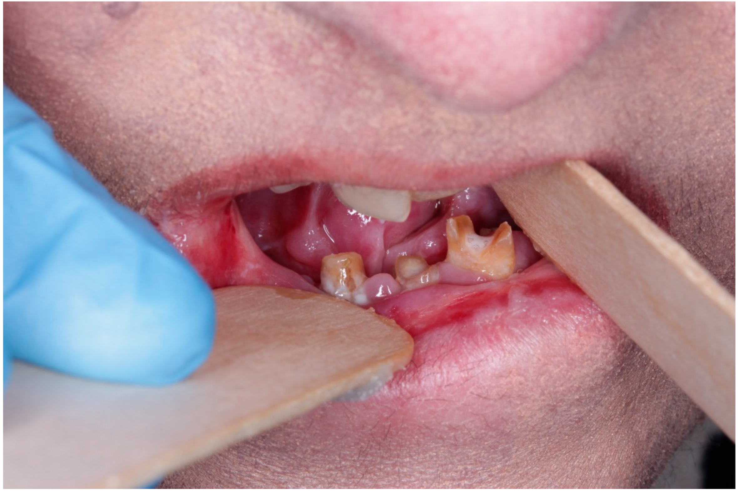 Dentistry 13 00398 g003