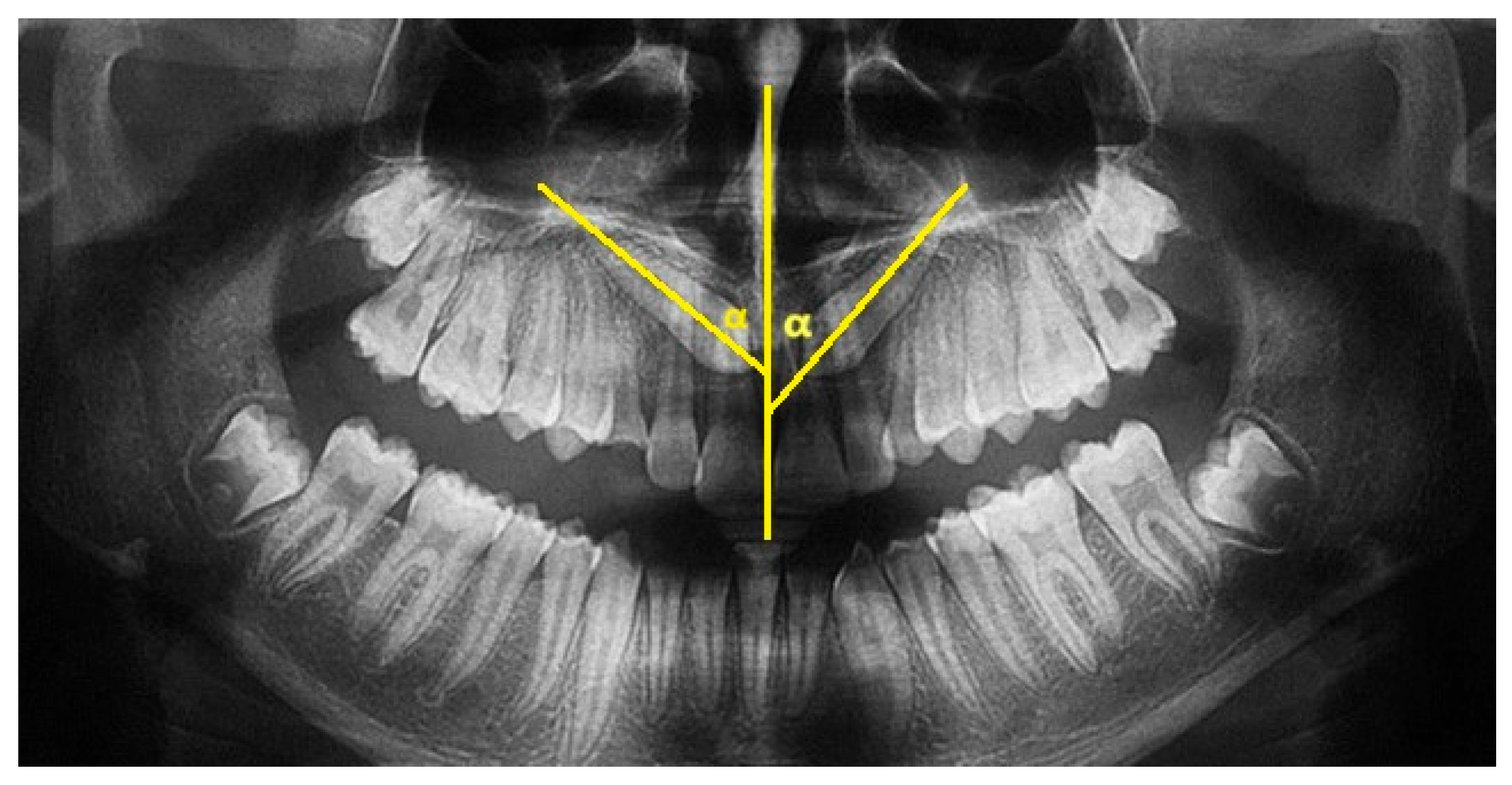 Dentistry 13 00399 g001