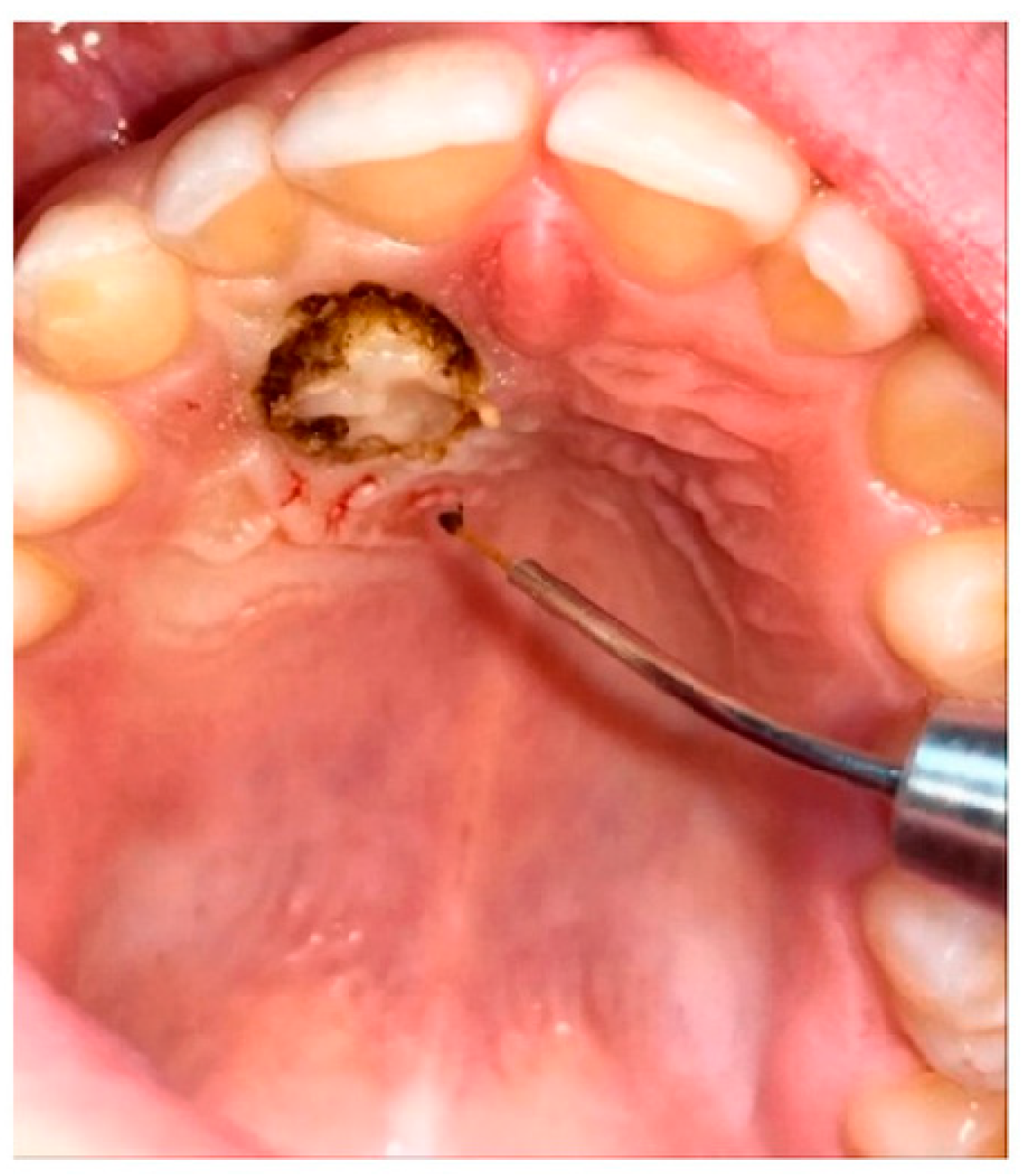 Dentistry 13 00399 g004