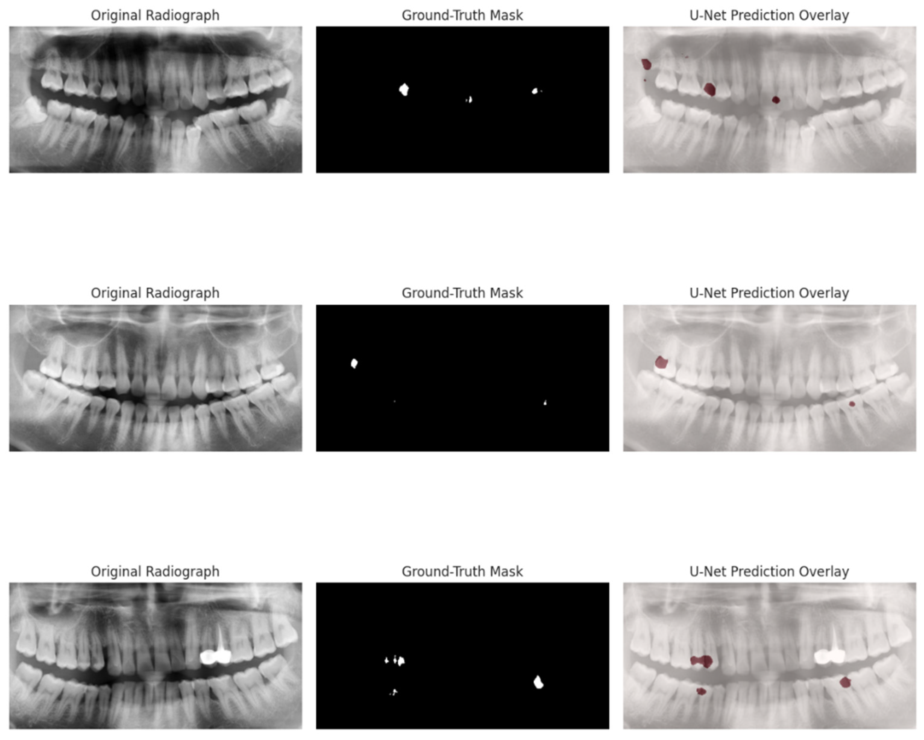 Dentistry 13 00402 g014 Dentistry 13 00402 g014