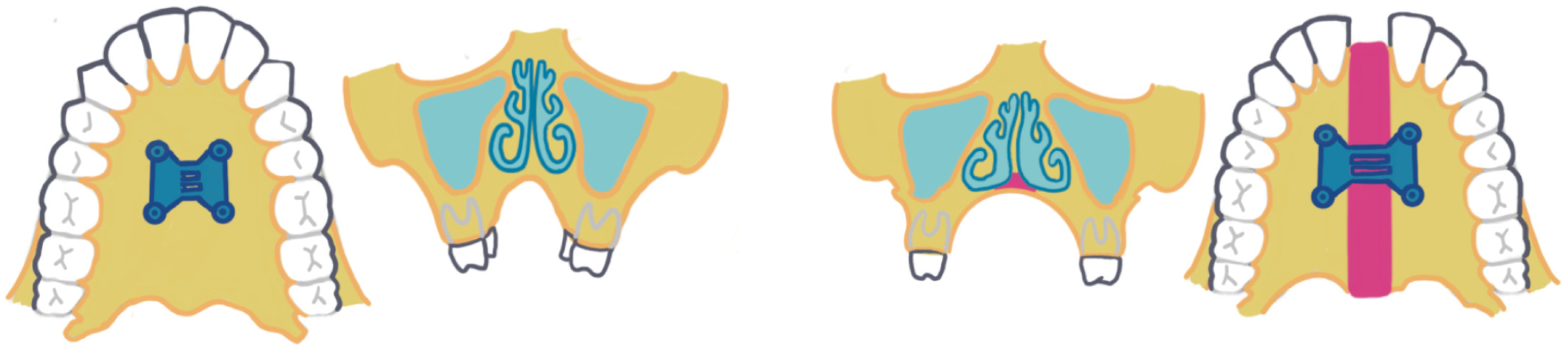 Dentistry 13 00410 g001 Dentistry 13 00410 g001