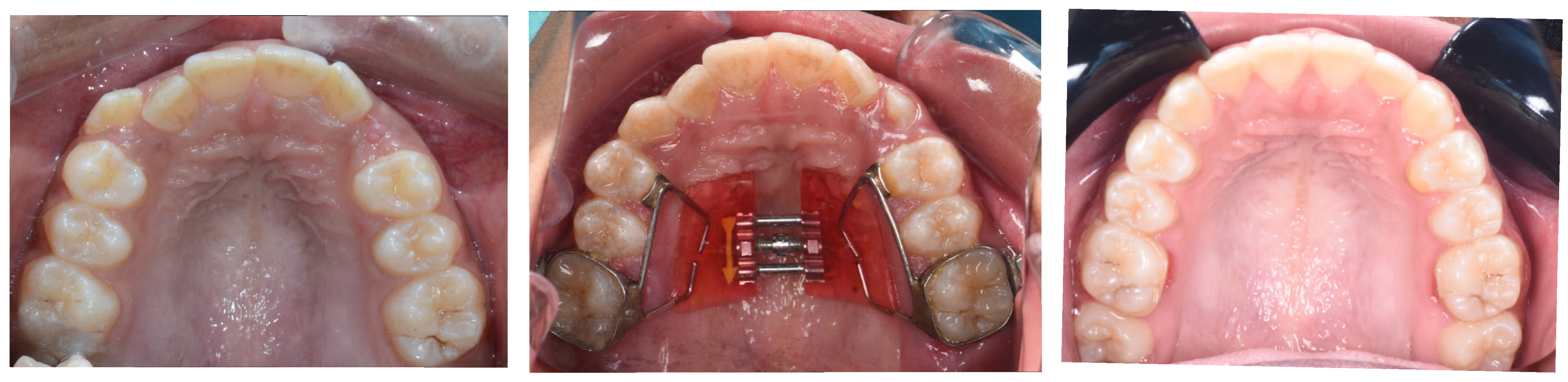 Dentistry 13 00410 g002 Dentistry 13 00410 g002