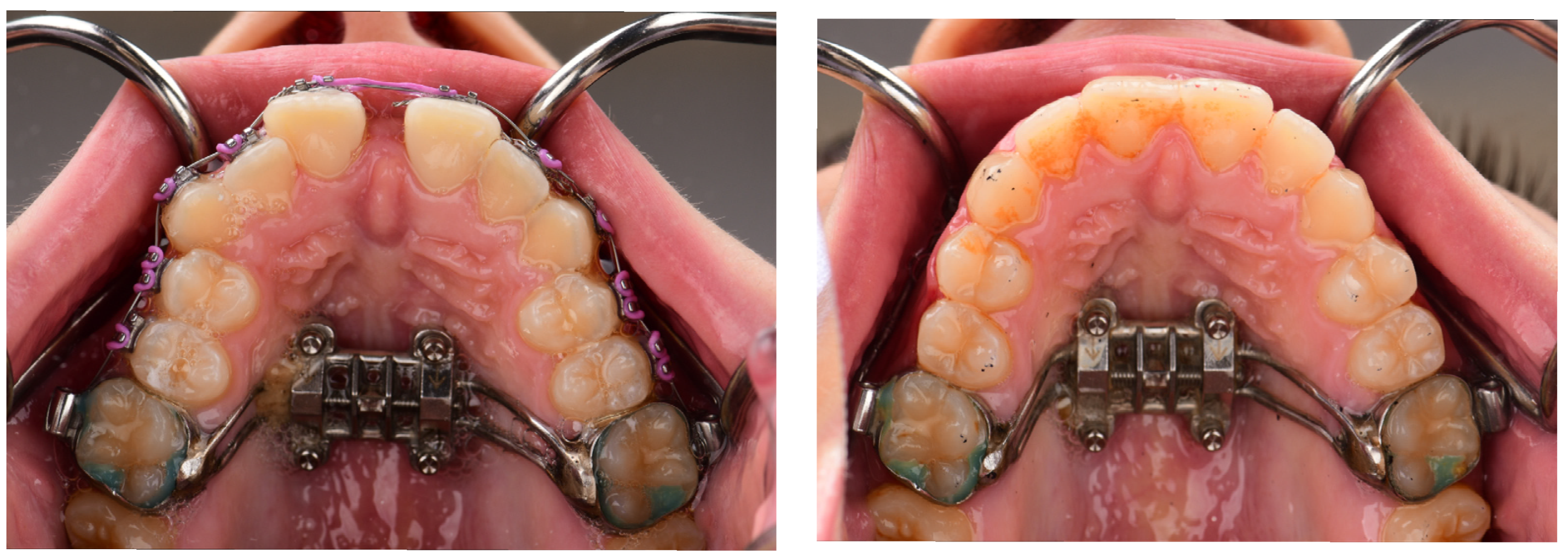 Dentistry 13 00410 g003 Dentistry 13 00410 g003