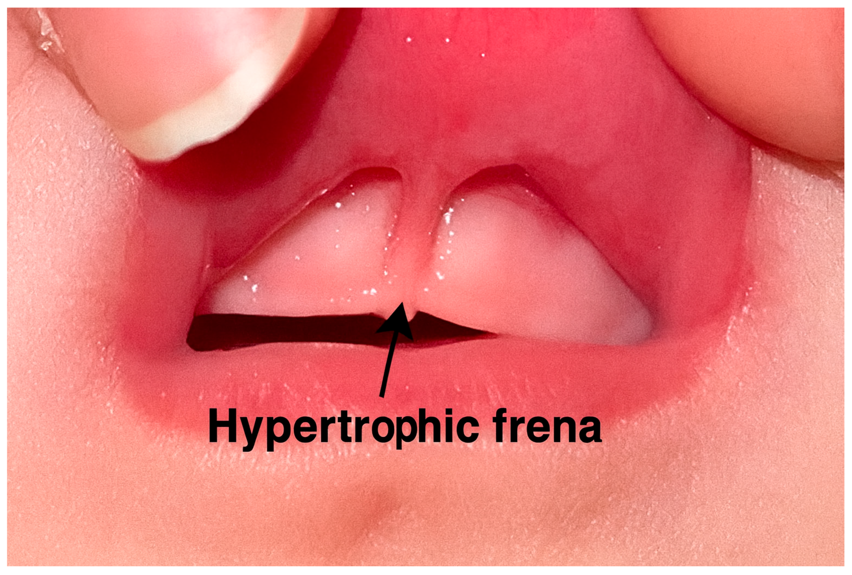 Dentistry 13 00414 g001