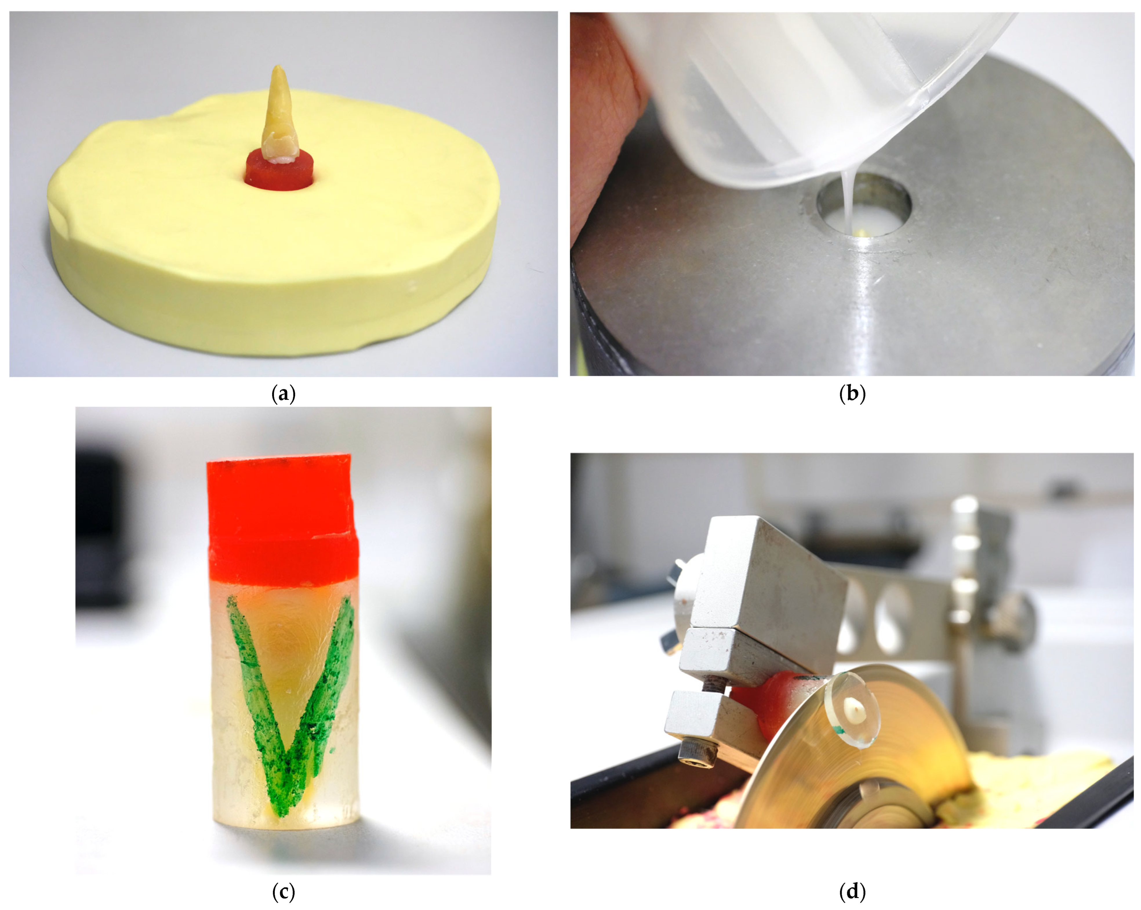 Dentistry 13 00415 g001 Dentistry 13 00415 g001