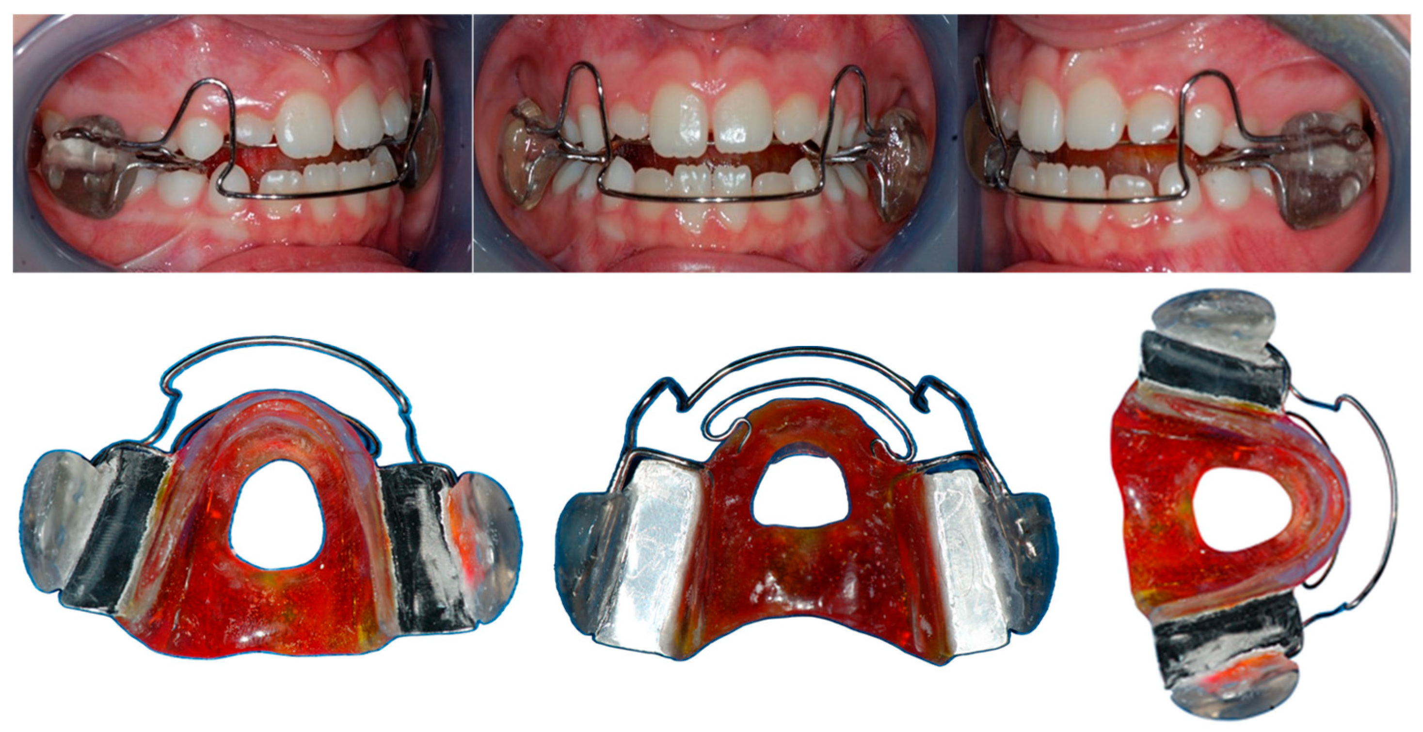 Dentistry 13 00427 g001 Dentistry 13 00427 g001