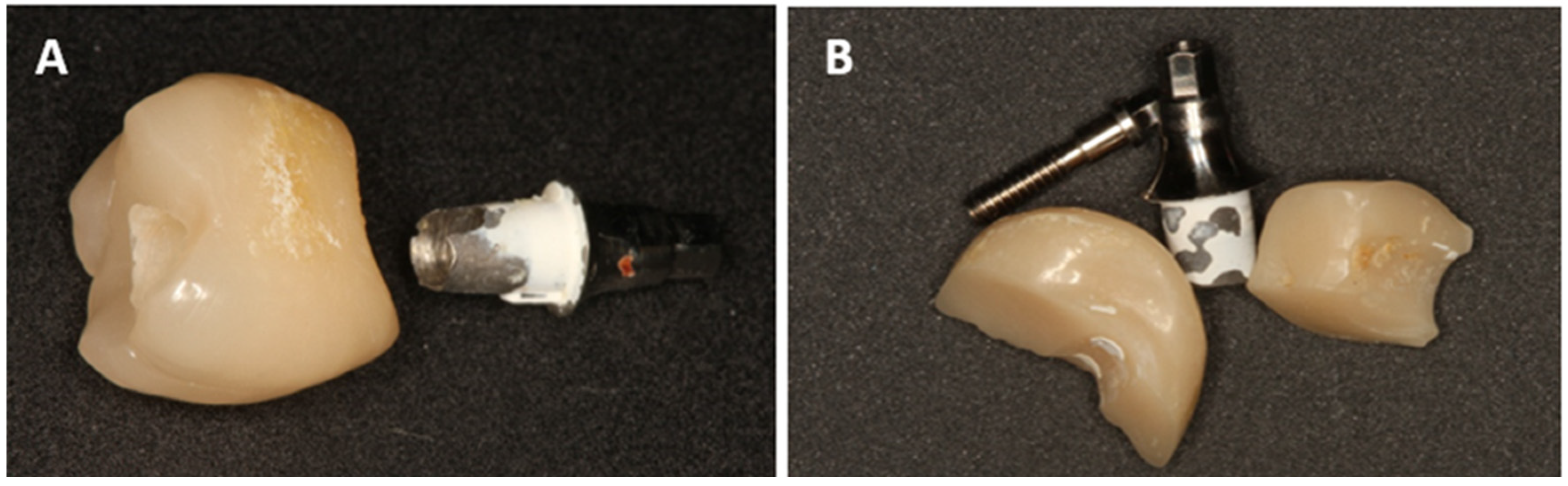 Dentistry 13 00430 g002