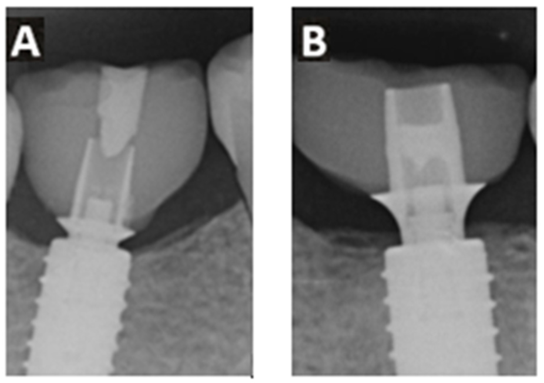 Dentistry 13 00430 g004