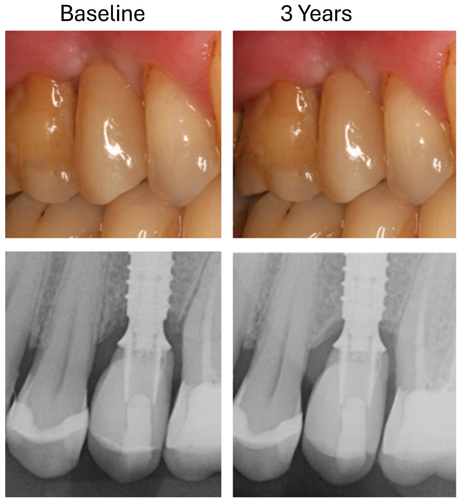 Dentistry 13 00430 g005