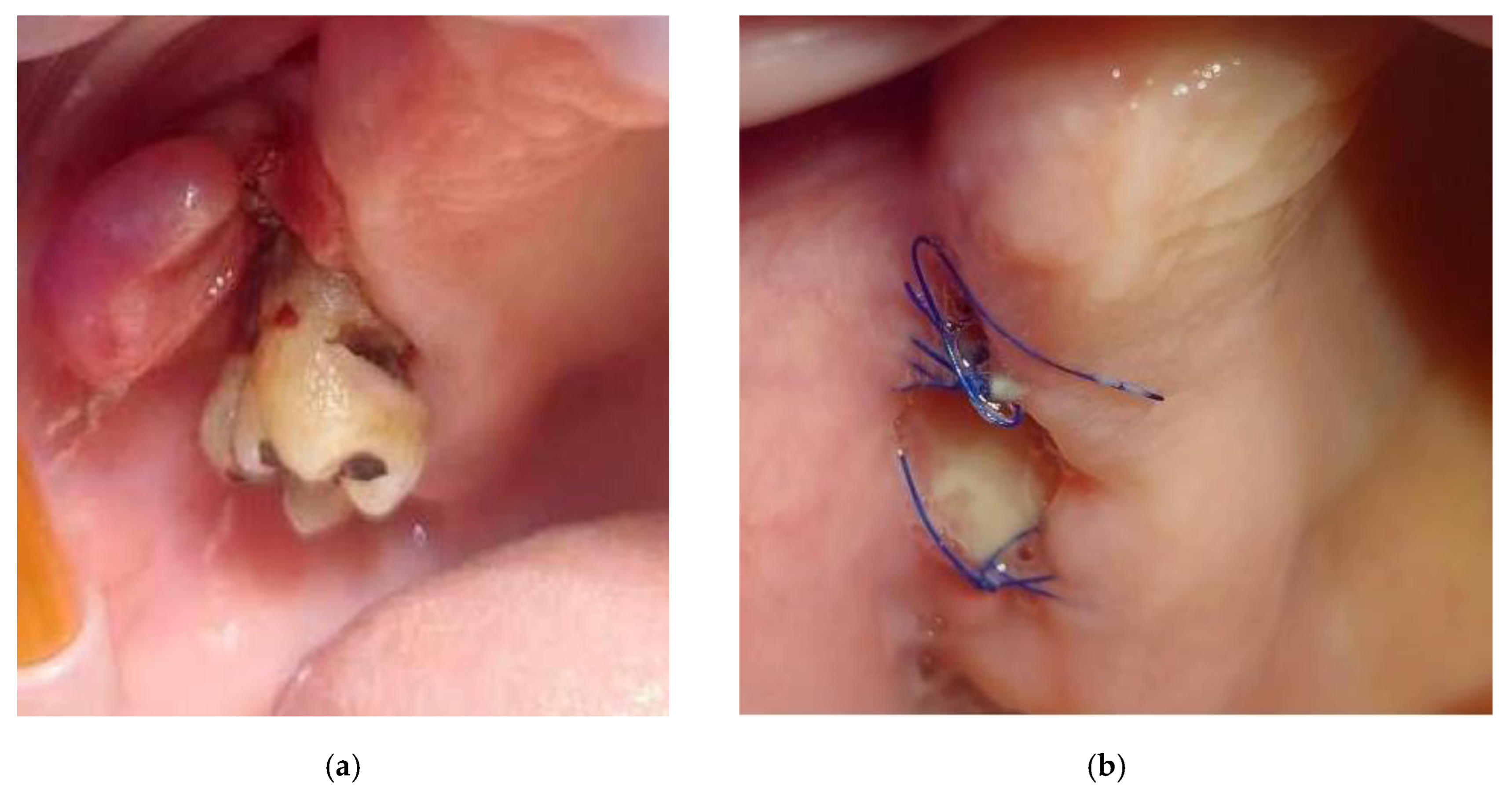 Dentistry 13 00432 g001