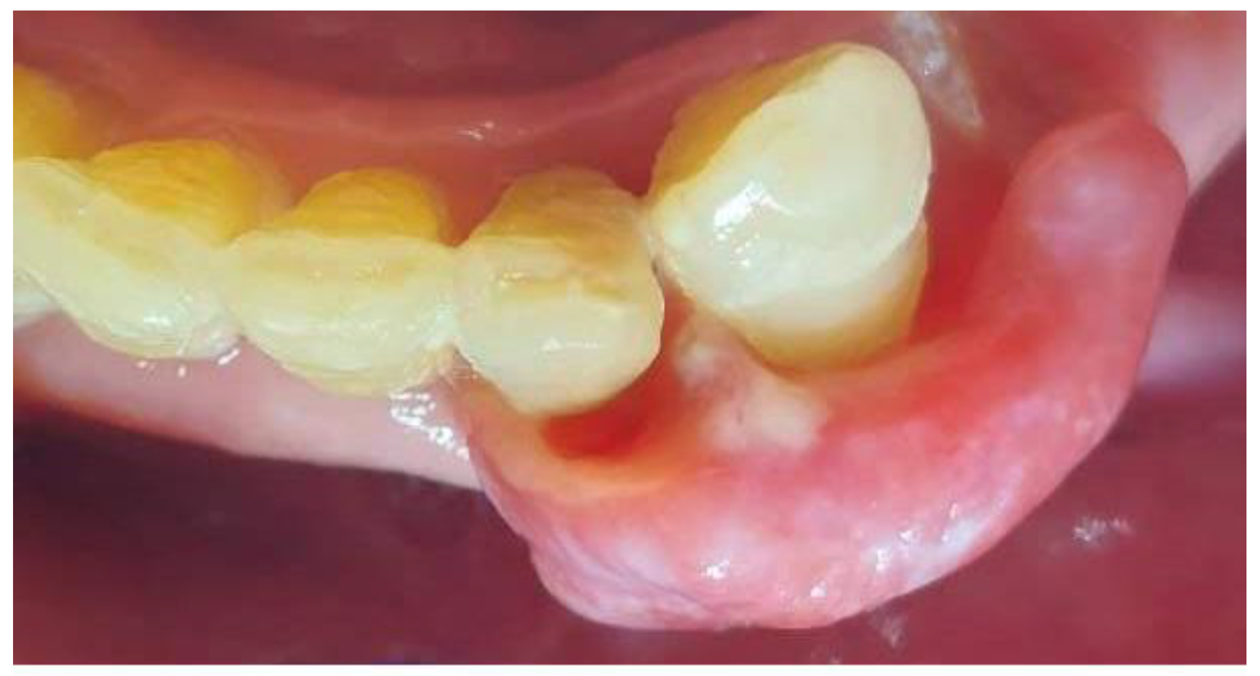 Dentistry 13 00432 g002