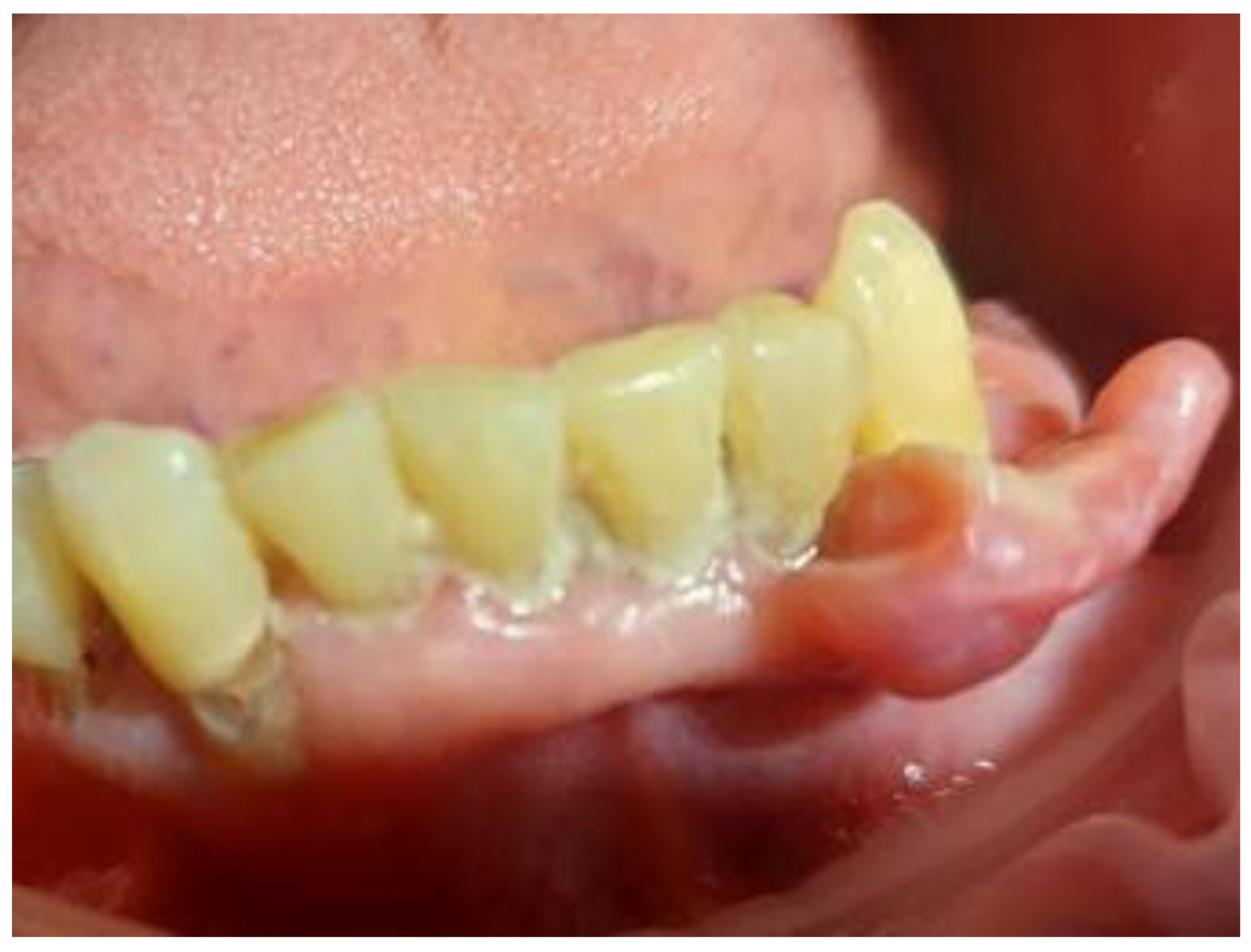 Dentistry 13 00432 g003