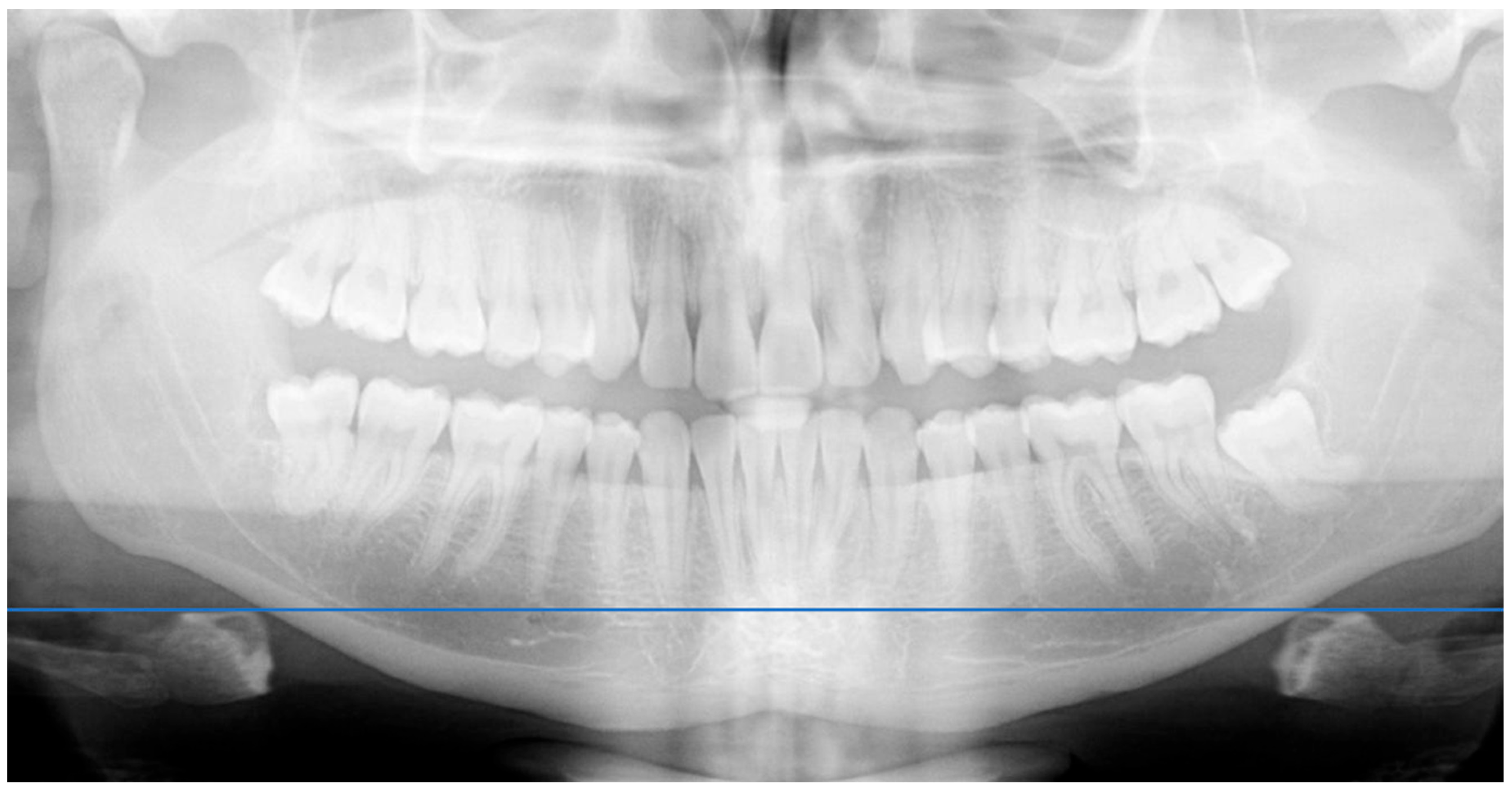 Dentistry 13 00451 g002