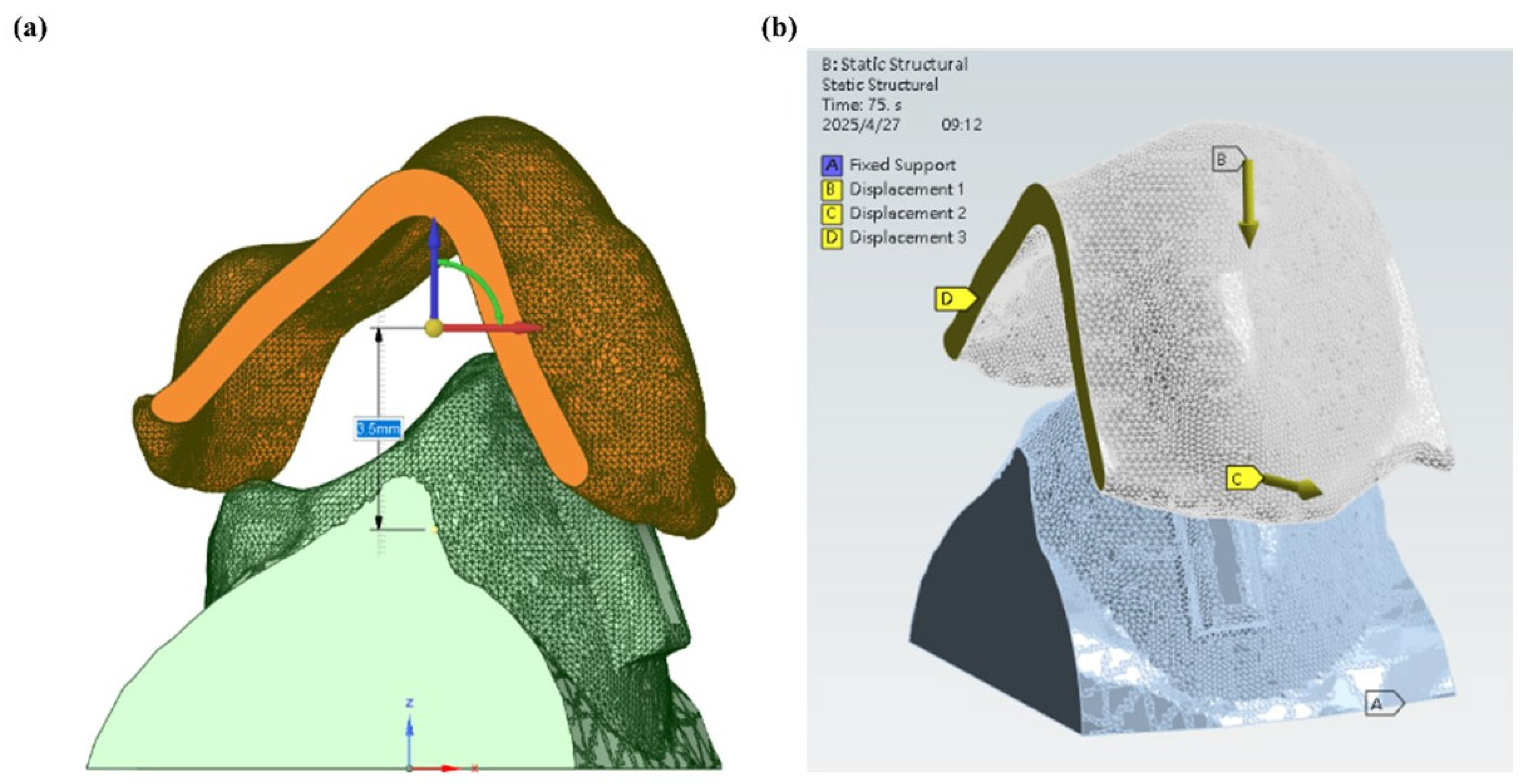Dentistry 13 00454 g005