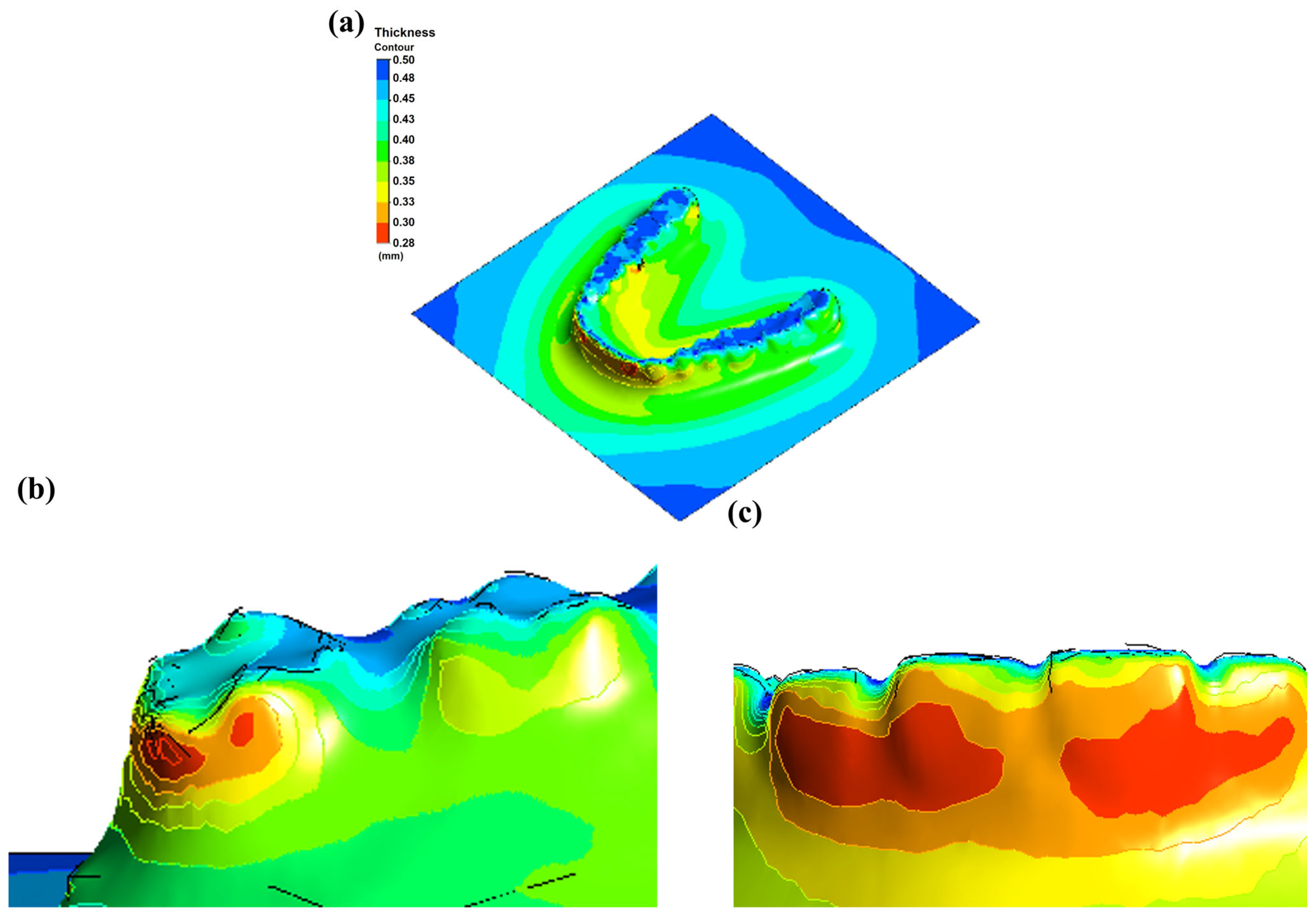 Dentistry 13 00454 g008