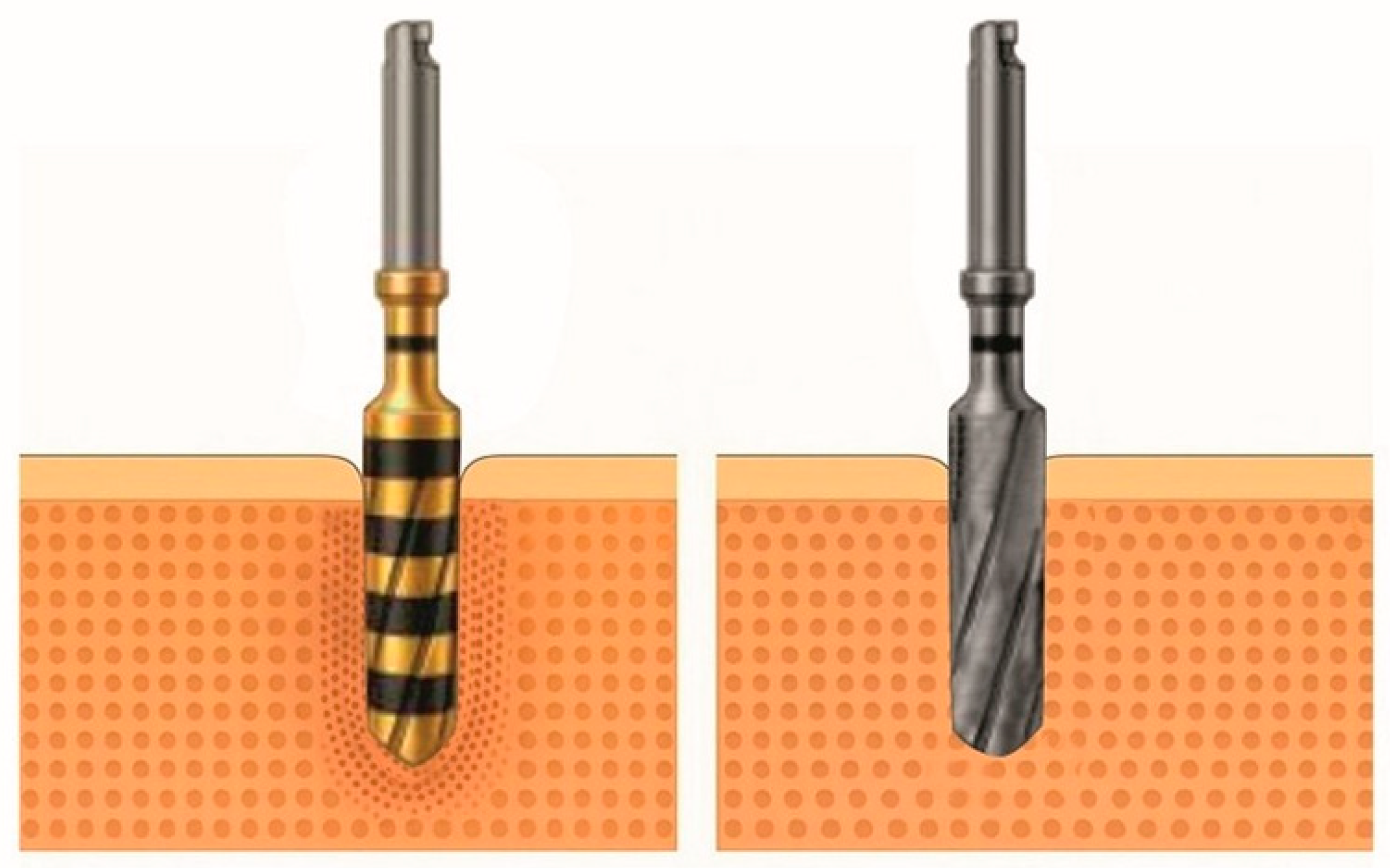 Dentistry 13 00461 g001 Dentistry 13 00461 g001