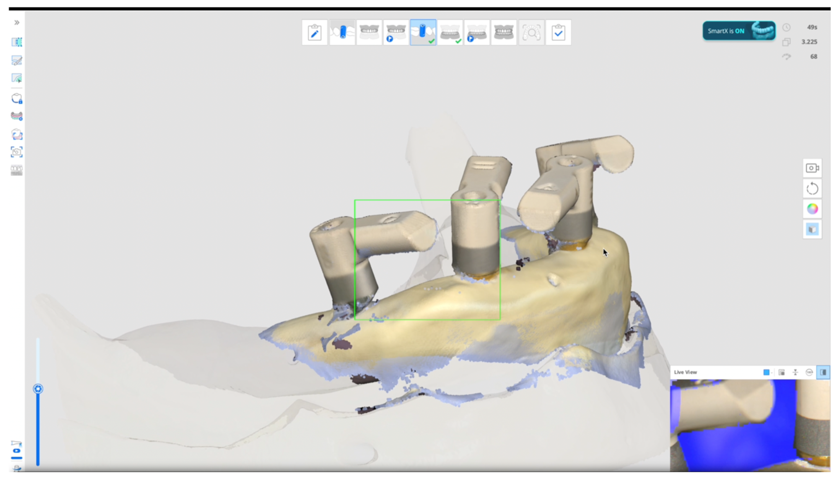 Dentistry 13 00462 g002 Dentistry 13 00462 g002